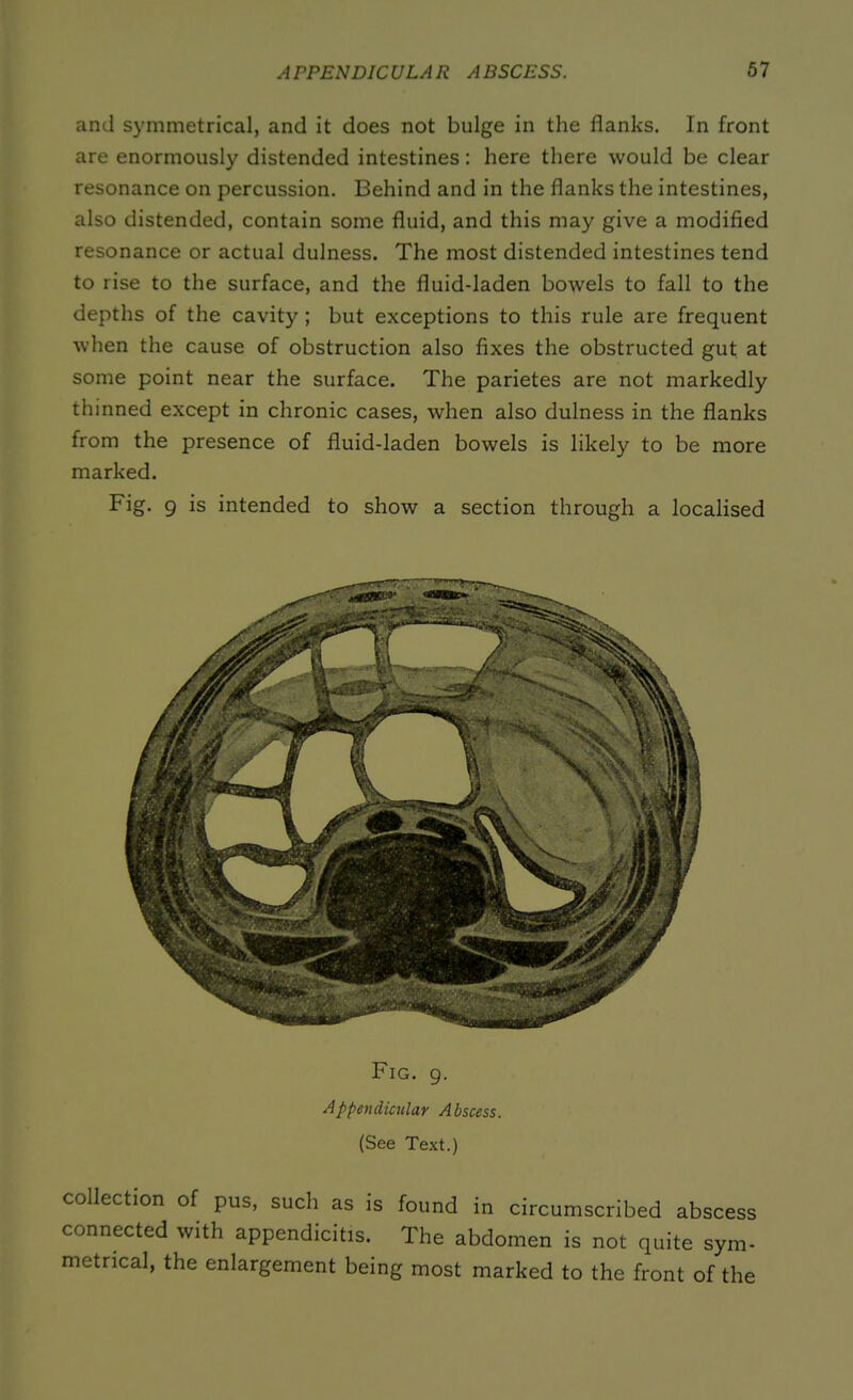 and symmetrical, and it does not bulge in the flanks. In front are enormously distended intestines: here there would be clear resonance on percussion. Behind and in the flanks the intestines, also distended, contain some fluid, and this may give a modified resonance or actual dulness. The most distended intestines tend to rise to the surface, and the fluiddaden bowels to fall to the depths of the cavity; but exceptions to this rule are frequent when the cause of obstruction also fixes the obstructed gut at some point near the surface. The parietes are not markedly thinned except in chronic cases, when also dulness in the flanks from the presence of fluid-laden bowels is likely to be more marked. Fig. 9 is intended to show a section through a localised Fig. 9. Appendicular Abscess. (See Text.) collection of pus, such as is found in circumscribed abscess connected with appendicitis. The abdomen is not quite sym- metrical, the enlargement being most marked to the front of the