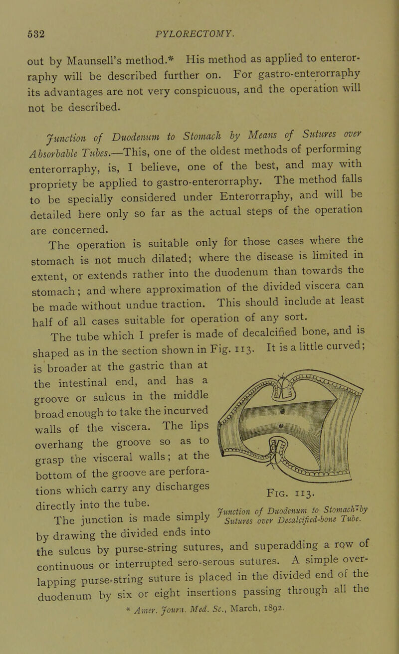 out by Maunsell’s method.*- His method as applied to enteror- raphy will be described further on. For gastro-enterorraphy its advantages are not very conspicuous, and the operation will not be described. Junction of Duodenum to Stomach by Means of Sutures over Absorbable Tubes.—This, one of the oldest methods of performing enterorraphy, is, I believe, one of the best, and may with propriety be applied to gastro-enterorraphy. The method falls to be specially considered under Enterorraphy, and will be detailed here only so far as the actual steps of the operation are concerned. The operation is suitable only for those cases where the stomach is not much dilated; where the disease is limited in extent, or extends rather into the duodenum than towards the stomach; and where approximation of the divided viscera can be made without undue traction. This should include at least half of all cases suitable for operation of any sort. The tube which I prefer is made of decalcified bone, and is shaped as in the section shown in Fig. 113. It is a little curved; is broader at the gastric than at the intestinal end, and has a groove or sulcus in the middle broad enough to take the incurved walls of the viscera. The lips overhang the groove so as to grasp the visceral walls , at the bottom of the groove are perfora- tions which carry any discharges directly into the tube. _ junction of Duodenum to StomaclAby The junction is made simply sutures over Decalcified-bone Tube. by drawing the divided ends into the sulcus by purse-string sutures, and superadding a rqw of continuous or interrupted sero-serous sutures. A simple over- lapping purse-string suture is placed in the divided end of the duodenum by six or eight insertions passing through all the * Amer. Journ. Med. Sc., March, 1892.
