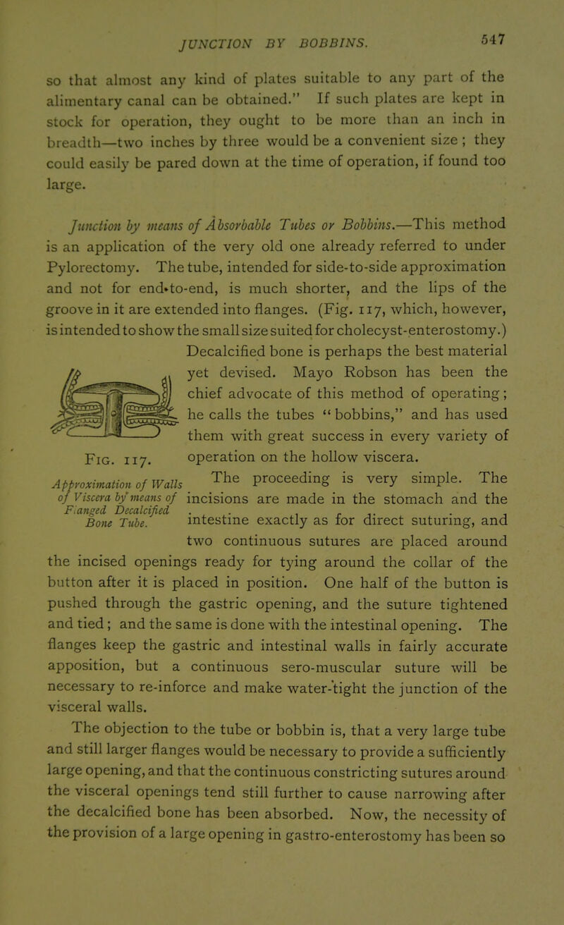 JUNCTION BY BOBBINS. so that almost any kind of plates suitable to any part of the alimentary canal can be obtained.” If such plates are kept in stock for operation, they ought to be more than an inch in breadth—two inches by three would be a convenient size ; they could easily be pared down at the time of operation, if found too large. Junction by means of Absorbable Tubes or Bobbins.—This method is an application of the very old one already referred to under Pylorectomy. The tube, intended for side-to-side approximation and not for end*to-end, is much shorter, and the lips of the groove in it are extended into flanges. (Fig. 117, which, however, is intended to show the small size suited for cholecyst-enterostomy.) Decalcified bone is perhaps the best material yet devised. Mayo Robson has been the chief advocate of this method of operating; he calls the tubes “ bobbins,” and has used them with great success in every variety of Fig. 117. operation on the hollow viscera. Approximation of Walls _ The prodding is very simple. The of Viscera by means of incisions are made in the stomach and the Flanged Decalcified . Bone Tube. intestine exactly as for direct suturing, and two continuous sutures are placed around the incised openings ready for tying around the collar of the button after it is placed in position. One half of the button is pushed through the gastric opening, and the suture tightened and tied ; and the same is done with the intestinal opening. The flanges keep the gastric and intestinal walls in fairly accurate apposition, but a continuous sero-muscular suture will be necessary to re-inforce and make water-tight the junction of the visceral walls. I he objection to the tube or bobbin is, that a very large tube and still larger flanges would be necessary to provide a sufficiently large opening, and that the continuous constricting sutures around the visceral openings tend still further to cause narrowing after the decalcified bone has been absorbed. Now, the necessity of the provision of a large opening in gastro-enterostomy has been so