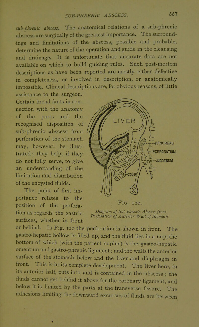 SUB-PHRENIC ABSCESS. sub-phrenic abscess. The anatomical relations of a sub-phrenic abscess are surgically of the greatest importance. I he surround- ings and limitations of the abscess, possible and probable, determine the nature of the operation and guide in the cleansing and drainage. It is unfortunate that accurate data are not available on which to build guiding rules. Such post-mortem descriptions as have been reported are mostly either defective in completeness, or involved in description, or anatomically impossible. Clinical descriptions are, for obvious reasons, of little assistance to the surgeon. Certain broad facts in con- nection with the anatomy of the parts and the recognised disposition of sub-phrenic abscess from perforation of the stomach may, however, be illus- trated ; they help, if they do not fully serve, to give an understanding of the limitation and distribution of the encysted fluids. The point of first im- portance relates to the position of the perfora- tion as regards the gastric surfaces, whether in front or behind. In Fig. 120 the gastro-hepatic hollow is filled up, and the fluid lies in a cup, the bottom of which (with the patient supine) is the gastro-hepatic omentum and gastro-phrenic ligament; and the walls the anterior surface of the stomach below and the liver and diaphragm in front. This is in its complete development. The liver here, in its anterior half, cuts into and is contained in the abscess ; the fluids cannot get behind it above for the coronary ligament, and below it is limited by the parts at the transverse fissure. The adhesions limiting the downward excursus of fluids are between Diagram of Sub-phrenic Abscess from Perforation of Anterior Wall of Stomach. perforation is shown in front. The