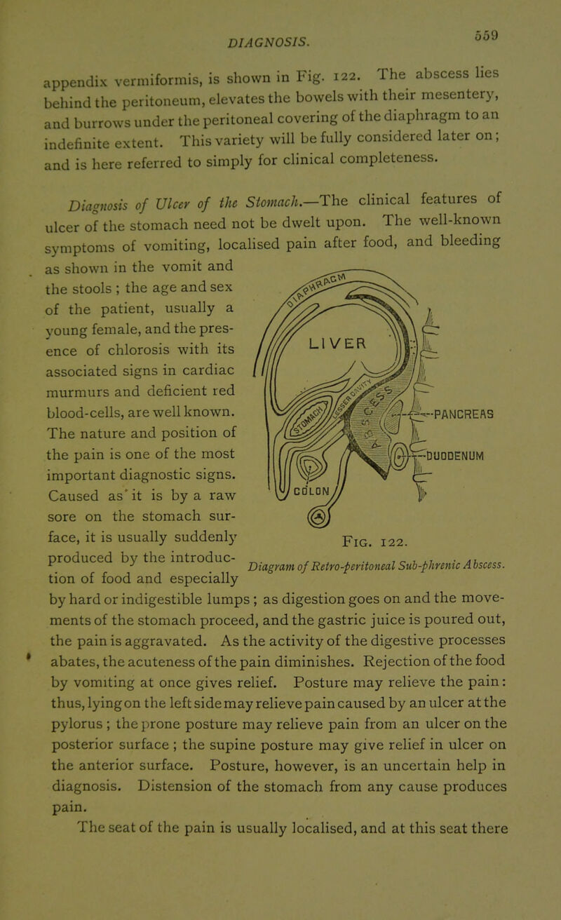 DIAGNOSIS. appendix vermiformis, is shown in Fig. 122. The abscess lies behind the peritoneum, elevates the bowels with their mesentery, and burrows under the peritoneal covering of the diaphragm to an indefinite extent. This variety will be fully considered later on; and is here referred to simply for clinical completeness. --•PANCREAS DUODENUM Diagnosis of Ulcer of the Stomach.—The clinical features of ulcer of the stomach need not be dwelt upon. The well-known symptoms of vomiting, localised pain after food, and bleeding as shown in the vomit and the stools ; the age and sex of the patient, usually a voung female, and the pres- ence of chlorosis with its associated signs in cardiac murmurs and deficient red blood-cells, are well known. The nature and position of the pain is one of the most important diagnostic signs. Caused as it is by a raw sore on the stomach sur- face, it is usually suddenl}7 produced by the introduc- tion of food and especially by hard or indigestible lumps ; as digestion goes on and the move- ments of the stomach proceed, and the gastric juice is poured out, the pain is aggravated. As the activity of the digestive processes abates, the acuteness of the pain diminishes. Rejection of the food by vomiting at once gives relief. Posture may relieve the pain: thus, lying on the left side may relieve pain caused by an ulcer at the pylorus ; the prone posture may relieve pain from an ulcer on the posterior surface ; the supine posture may give relief in ulcer on the anterior surface. Posture, however, is an uncertain help in diagnosis. Distension of the stomach from any cause produces pain. The seat of the pain is usually localised, and at this seat there Fig. 122. Diagram of Retro-peritoneal Sub-plirenic Abscess.