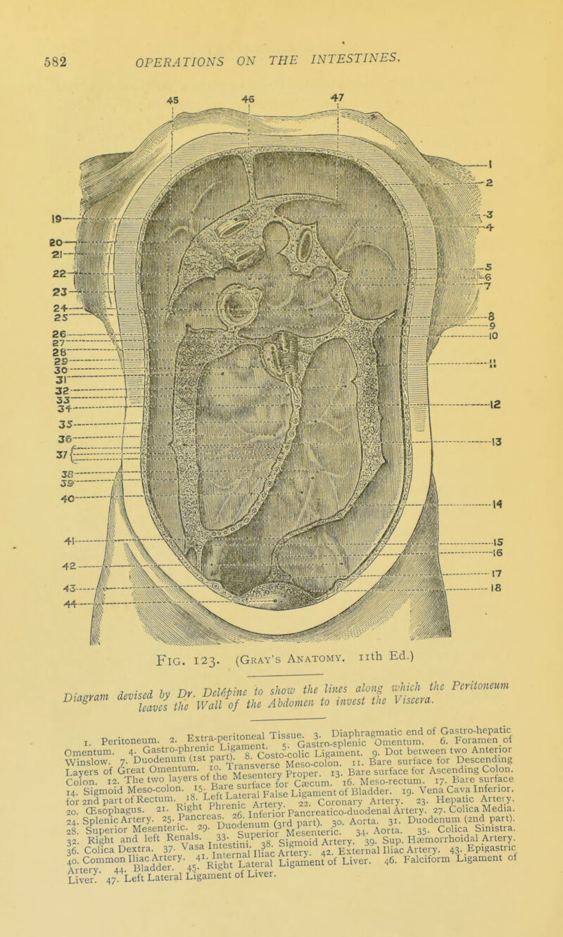 Fig. 123. (Gray's Anatomy, nth Ed.) * . . n„ ndfMne to show the lines along which the Peritoneum Digram ^^s^^:fZ lumn to invest the Viscera. , Peritoneum. , ft***-* ^J^^^^^^T^ Omentum. 4- Ga?tr°-P^e™£ PT costo-coHc Ligament. 9- Dot between two Anterior Winslow. 7- Duodenum list pait), J-v^0|;°MeSo-colon. li. Bare surface for Descending Layers of Great Omentum. 10 liansveise wes re {Qr Ascending Colon. Colon. 12. The two layers of thMesentery «°Pe / j6 Mes0.rectum. I? Bare surface 14. Sigmoid Meso-colon. >5^e ce Ligament of Bladder. 19. Vena Cava Inferior. forandpartofRectum. 18. Lett Lateia^ r 6 Coronary Artery. 23. Hepatic Artery. 20. CEsophagus. ax. %%^^e^i^UTV^re^0^odm^kW. 27. Colica Media 24. Splenic Artery. 25. Pancieas. 2■ M t). 30. Aorta. 31. Duodenum (2nd part). 28. Superior Mesenteric. 29. Duodenum (ya.par3 3 CoUca Smistra 32. Right and left Renals. 33; »■ P« orsS Artery. 39. Sup. Hemorrhoidal Artery. 336. Colica Dextra 37- Vasa IntesWH. 38. Sigmoid Aitery 39 ^ ^ Epigastric Jo. Common Iliac Artery■ 41^^^ Artery^ ^ ^ Fakiform Llgament ol Liven' 4744Left Lateral Ligament of Liver.