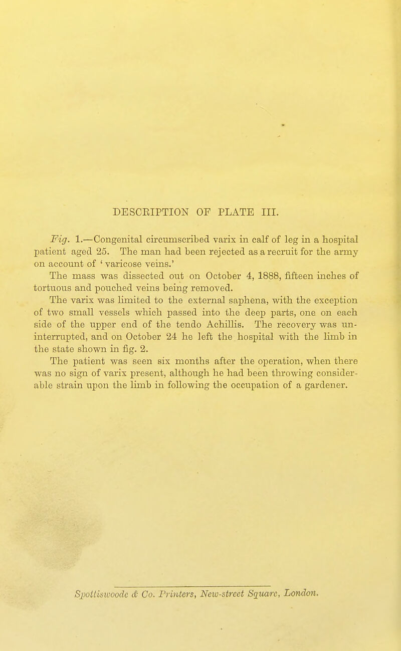 Fig. 1.—Congenital circumscribed varix in calf of leg in a hospital patient aged 25. The man had been rejected as a recruit for the anny on account of ' varicose veins.' The mass was dissected out on October 4, 1888, fifteen inches of tortuous and pouched veins being removed. The varix was limited to the external saphena, with the exception of two small vessels which passed into the deep parts, one on each side of the upper end of the tendo Achillis. The recovery was un- interrupted, and on October 24 he left the hospital with the limb in the state shown in fig. 2. The patient was seen six months after the operation, when there was no sign of varix present, although he had been throwing consider- able strain upon the limb in following the occupation of a gardener. Spottisivoodc <£• Co. Printers, Neto-street Sqtiarc, London.