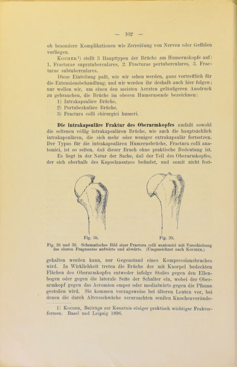 ob besondere Komplikationeu wie Zerreißung- von Nerven oder Gefäßen vorliegen. Kocher 1) stellt 3 Haupttypen der Brüche am Humeruskopfe auf: 1. Fracturae supratuberculares, 2. Fracturae pertuberculares, 3. Frac- turae subtuberculares. Diese Einteilung paßt, wie wir sehen werden, ganz vortreftlich für die Extensionsbeliandlung, und wir werden ihr deshalb auch hier folgen; nur wollen wir, um einen den meisten Aerzten geläufigeren Ausdruck zu gebrauchen, die Brüche im oberen Huraerusende bezeichnen: 1) lutrakapsuläi'e l^rüche, 2) Pertuberkuläre Brüche. 3) Fractura colli chirurgici humeri. Die intrakapsuläre Fraktur des Oberarmkopfes umfaßt sowohl die seltenen völlig intrakapsulären Brüche, wie auch die hauptsächlich intrakapsulären, die sich mehr oder weniger extrakapsulär fortsetzen. Der Tj'pus für die intrakapsulären Humerusbrüche, Fractura colli ana- tomici, ist so selten, daß dieser Bruch ohne praktische Bedeutung ist. Es liegt in der Natur der Sache, daß der Teil des Oberarmkopfes, der sich oberhalb des Kapselansatzes befindet, und somit nicht fest- Fig. 38. Fig. 39. Fig. 38 und 39. Schematisches Bild einer Fractura colli anatomici mit Verschiebung des oberen Fragmentes aufwärts und abwärts. (Umgezeichnet nach Kocher.) gehalten werden kann, nur Gegenstand eines Kompressionsbruches wird. In Wirklichkeit treten die Brüche der mit Knorpel bedeckten Flächen des Oberarmkopfes entweder infolge Stoßes gegen den Ellen- bogen oder gegen die laterale Seite der Schulter ein, wobei der Ober- armkopf gegen das Acromion empor oder medialwärts gegen die Pfanne gestoßen wird. Sie kommen vorzugsweise bei älteren Leuten vor, bei denen die durch Altersschwäche verursachten senilen Knochenverände- 1) Kocher, Beiträge zur Kenntnis einiger praktisch wichtiger Fraktur- formen. Basel und Leipzig 1896.