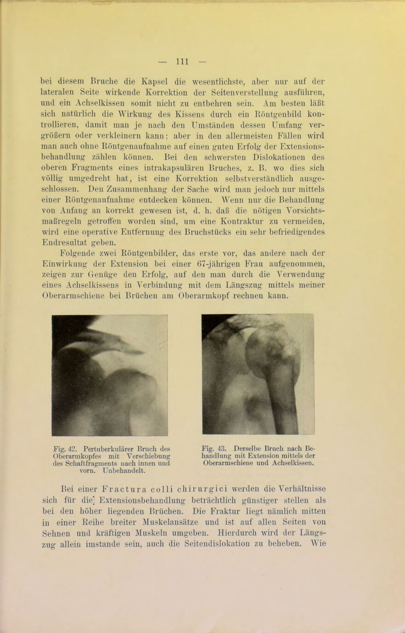 bei diesem Bruche die Kapsel die wesentlichste, aber nur auf der lateralen Seite wirkende Korrektion der Seitenverstellung ausführen, und ein Achselkissen somit nicht zu entbehren sein. Am besten läßt sicli natürlich die Wirkung des Kissens durch ein Röntgenbild kon- trollieren, damit mau je nach den Umständen dessen Umfang ver- größern oder verkleinern kann; aber in den allermeisten Fällen wird man auch ohne Röntgenaufnahme auf einen guten Erfolg der Extensions- behandluug zählen können. Bei den schwersten Dislokationen des oberen Fragments eines intrakapsulären Bruches, z. B. wo dies sich völlig umgedreht hat, ist eine Korrektion selbstverständlich ausge- schlossen. Den Zusammenhang der Sache wird man jedoch nur mittels einer Röntgenaufnahme entdecken können. Wenn nur die Behandlung von Anfang an korrekt gewesen ist, d. h. daß die nötigen Vorsichts- maßregeln getroffen worden sind, um eine Kontraktur zu vermeiden, wird eine operative Entfernung des Bruchstücks ein sehr befriedigendes Endresultat geben. Folgende zwei Röntgenbilder, das erste vor, das andere nach der Einwirkung der Extension bei einer 67-jährigen Frau aufgenommen, zeigen zur Genüge den Erfolg, auf den man durch die Verwendung eines Achselkissens in Verbindung mit dem Längszug mittels meiner Oberarmschiene bei Brüchen am Oberarmkopf rechnen kann. Fig, 42. Pertuberkulärer Bruch des Oberarmkopfes mit Verschiebung des Schaftfragraents nach innen und vorn. Unbehandelt. Fig. 43. Derselbe Bruch nach Be- handlung mit Extension mittels der Oberarmschiene und Achselkissen, Bei einer Fractura colli chirurgici werden die Verhältnisse sich für die] Extensionsbehandlung beträchtlich günstiger stellen als bei den höher liegenden Brüchen. Die Fraktur liegt nämlich mitten in einer Reihe breiter Muskelansätze und ist auf allen Seiten von Sehnen und kräftigen Muskeln umgeben. Hierdurch wird der Längs- zug allein imstande sein, auch die Seitendislokatiou zu beheben. Wie