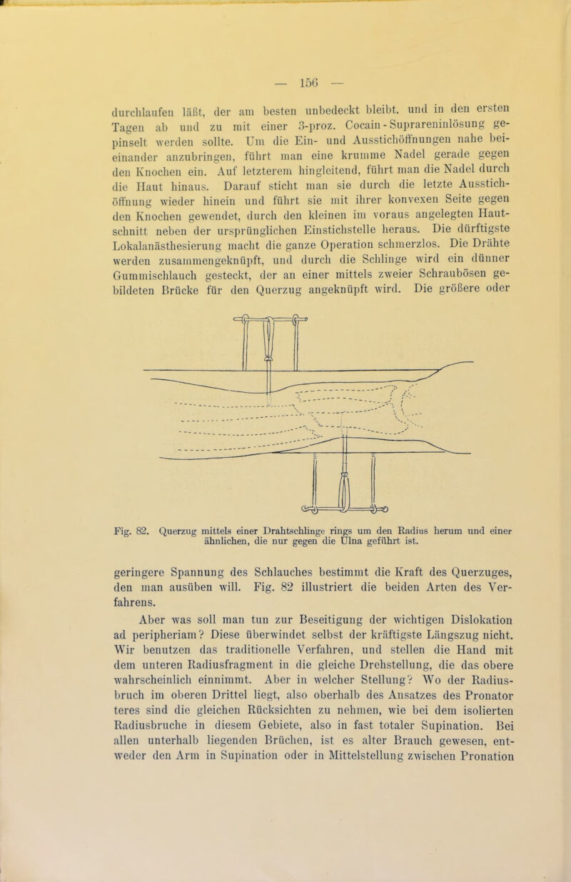 durchlaufen läßt, der am besten unbedeckt bleibt, und in den ersten Tagen ab und zu mit einer 3-proz. Cocain - Suprareninlösung ge- pinselt werden sollte. Um die Ein- und Aussticliöffnungen nahe bei- einander anzubringen, führt man eine krumme Nadel gerade gegen den Knochen ein. Auf letzterem hingleitend, führt man die Nadel durch die Haut hinaus. Darauf sticht man sie durch die letzte Ausstich- öffnung wieder hinein und führt sie mit ihrer konvexen Seite gegen den Knochen gewendet, durch den kleinen im voraus angelegten Haut- schnitt neben der ursprünglichen Einstichstelle heraus. Die dürftigste Lokalanästhesierung macht die ganze Operation schmerzlos. Die Drähte werden zusammengeknüpft, und durch die Schlinge wird ein dünner Gummischlauch gesteckt, der an einer mittels zweier Schraubösen ge- bildeten Brücke für den Querzug angeknüpft wird. Die größere oder J L )\=0 Fig. 82. Querzug mittels einer Drahtschlinge rings um den Radius herum und einer ähnliclien, die nur gegen die ülna geführt ist. geringere Spannung des Schlauches bestimmt die Kraft des Querzuges, den man ausüben will. Fig. 82 illustriert die beiden Arten des Ver- fahrens. Aber was soll man tun zur Beseitigung der wichtigen Dislokation ad peripheriam? Diese überwindet selbst der kräftigste Längszug nicht. Wir benutzen das traditionelle Verfahren, und stellen die Hand mit dem unteren Radiusfragment in die gleiche Drehstellung, die das obere wahrscheinlich einnimmt. Aber in welcher Stellung? Wo der Radius- bruch im oberen Drittel liegt, also oberhalb des Ansatzes des Pronator teres sind die gleichen Rücksichten zu nehmen, wie bei dem isolierten Radiusbruche in diesem Gebiete, also in fast totaler Supination. Bei allen unterhalb liegenden Brüchen, ist es alter Brauch gewesen, ent- weder den Arm in Supination oder in Mittelstellung zwischen Pronation