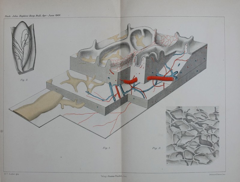 Ncvch John. Hopkins Hosp. BiUL. Apr. - June^ 1901. M T. Sudler |e2. ^ LitK/tnstv.KWesserJer.a. Verlag v. Gustav Fischer, J^i^a