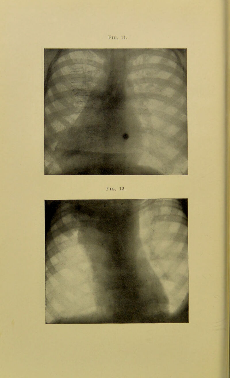 Fl(!. ]]. Fig. 12.