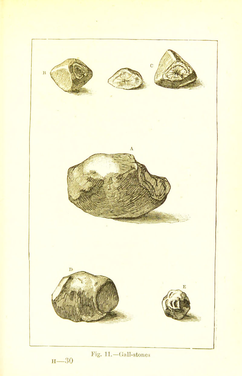 Fig. 11.—(liill-stone;-) II—.*30