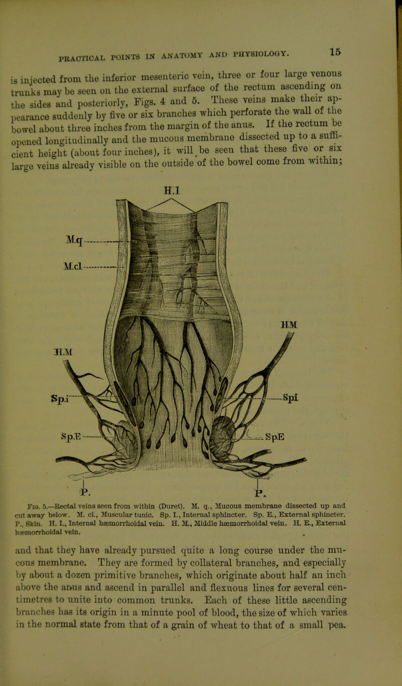 IS injected from the inferior mesenteric vein, three or four large venous trunks may be seen on the external surface of the rectum ascending on the sides and posteriorly, Figs. 4 and 5. Tliese veins make their ap- pearance suddenly by five or six branches which perforate the wall of the bowel about three inches from the margin of the anus. If the rectum be opened longitudinally and the mucous membrane dissected up to a suffi- cient height (about four inclies), it wiU^e seen that these five or six large veins already visible on the outside of the bowel come from withm; Fio. 5.—Rectal veins seen from within (Duret). M. q., Mucous membrane dissected up and cut away below. M. cl., Muscular tunic. Sp. I., Internal sphincter. Sp. E., External sphincter. P., Skin. H. I., Internal haemorrholdal vein. H. M., Middle hsemorrhoidal vein. H. E., External hsemorrhoidal vein. and that they have already pursued quite a long course under the mu- cous membrane. They are formed by collateral branches, and especially by about a dozen primitive branches, which originate about half an inch above the an-us and ascend in parallel and flexuous lines for several cen- timetres to unite into common trunks. Each of these little ascending branches has its origin in a minute pool of blood, the size of which varies in the normal state from that of a grain of wheat to that of a small pea.