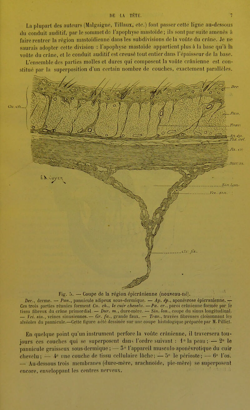 La plupart des autours (Malgaigno, Tillaux, etc.) font passer celle ligne au-dessous du conduit auditif, par le sommet do l'apophyse mastoïde; ils sont par suite amenés à faire rentrer la région mastoïdienne dans les subdivisions delà voûte du crâne. Je ne saurais adopter celte division : l'apophyse mastoïde appartient plus à la base qn'h Ih voûte du crâne, et le conduit auditif est creusé tout entier dans l'épaisseur de la base. L'ensemble des parties molles et dures qui composent la voûte crânienne est con- stitué par la superposition d'un certain nombre de couches, exactement parallèles. Fig. 5. — Coupe de la région épicrànienne (nouveau-né). Der., derme. — Pan., pannicule adipeux sous-dermique. — Ap. ép., aponévrose épicrànienne. — Ces trois parties réunies forment Cu. ch., le cuir chevelu. —Pa. cr., paroi crânienne formée par le tissu fibreux du crâne primordial. — Du7: m., dure-mère. — Sin. Ion., coupe du sinus longitudinal. — Vei. sin., veines sinusiennes.— Gr. fa., grande faux. — Trav., travées fibreuses cloisonnant I03 alvéoles du pannicule.—Cette ligure aété dessinée sur utio coupe liistologique préparée par M. Pillie.t. En quelque point qu'un instrument perfore la voûte crAnienne, il traversera tou- jours ces couches qui se superposent dans l'ordre suivant : i°\a peau;— 2 le pannicule graisseux sous-dermique ; — 3 l'appareil musculo aponévrotique du cuir chevelu; — 4 une couche de tissu cellulaire lâche; —5 le périoste; — 6» l'os. — Au-dessous trois membranes (dure-mère, arachnoïde, pie-mère) se superposent encore, enveloppant les cenires nerveux.