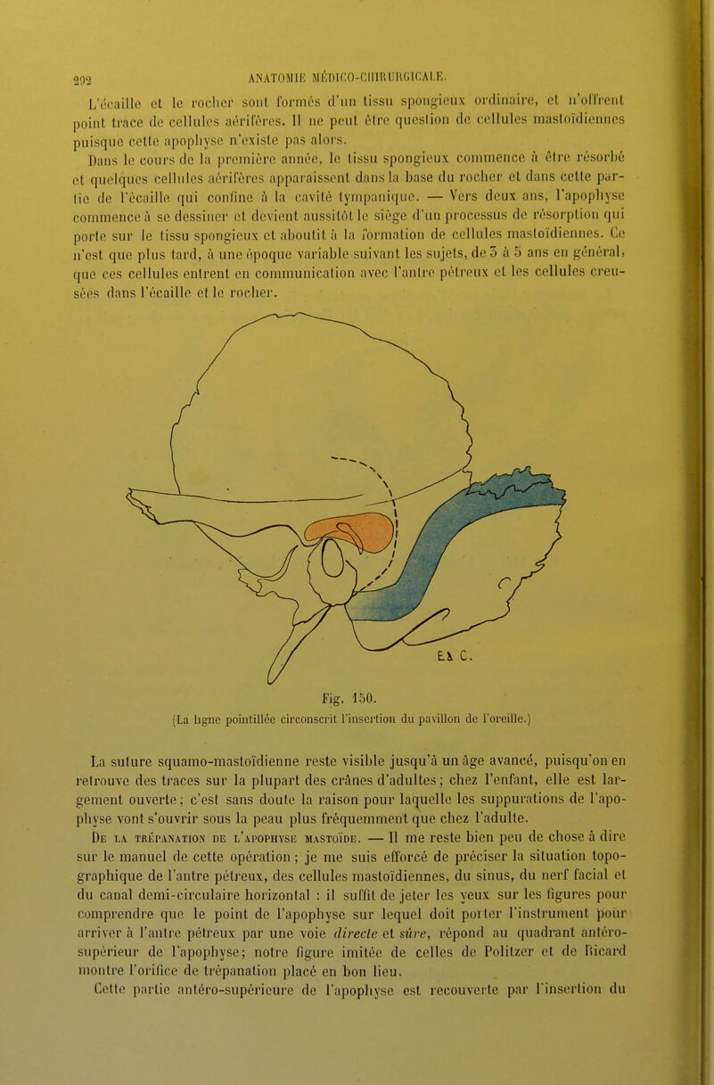 L'écaillé et le roclier sont formés d'un lissii spongieux ordinaire, et n'offrent point trace de cellules aérifères. 11 ne peut être qucsiion de cellules mastoïdiennes puisque cette apophyse n'existe pas alors. Dans le cours de la première année, le tissu spongieux commence à être résorbé et quelques cellules aérifères apparaissent dans la base du rocher et dans cette par- lie de l'écaillé qui confine à la cavité tympanique. — Vers deux ans, l'apophyse commence à se dessiner et devient aussitôt le siège d'un processus de résorption qui porte sur le tissu spongieux et aboutit à la formation de cellules mastoïdiennes. Ce n'est que plus tard, à une époque variable suivant les sujets, de 5 à 5 ans en général, que ces cellules entrent en communication avec l'anlre pétreux et les cellules creu- sées dans l'écaillé et le rocher. Fig. 150. (La ligne pointillée circonscrit l'insertion du pavillon de l'oreille.) La suture squamo-mastoïdienne reste visible jusqu'à un âge avancé, puisqu'on en retrouve des traces sur la plupart des crânes d'adultes; chez l'enfant, elle est lar- gement ouverte; c'est sans doute la raison pour laquelle les suppurations de l'apo- physe vont s'ouvrir sous la peau plus fréquemment que chez l'adulte. De la TRÉPANATION' DE l'apopiiyse mastoïde. — Il me reste bien peu de chose à dire sur le manuel de cette opération ; je me suis efforcé de préciser la situation topo- graphique de l'antre pétreux, des cellules mastoïdiennes, du sinus, du nerf facial et du canal demi-circulaire horizontal : il suffit de jeter les yeux sur les figures pour comprendre que le point de l'apophyse sur lequel doit porter l'instrument pour arriver à l'antre pétreux par une voie directe et sûre, répond au quadrant anféro- supérieur de l'apophyse; notre figure imitée de celles de Politzer et de Ricard montre l'orifice de trépanation placé en bon lieu. Celte partie antéro-supéricure de l'apophyse est recouverte par l'insertion du