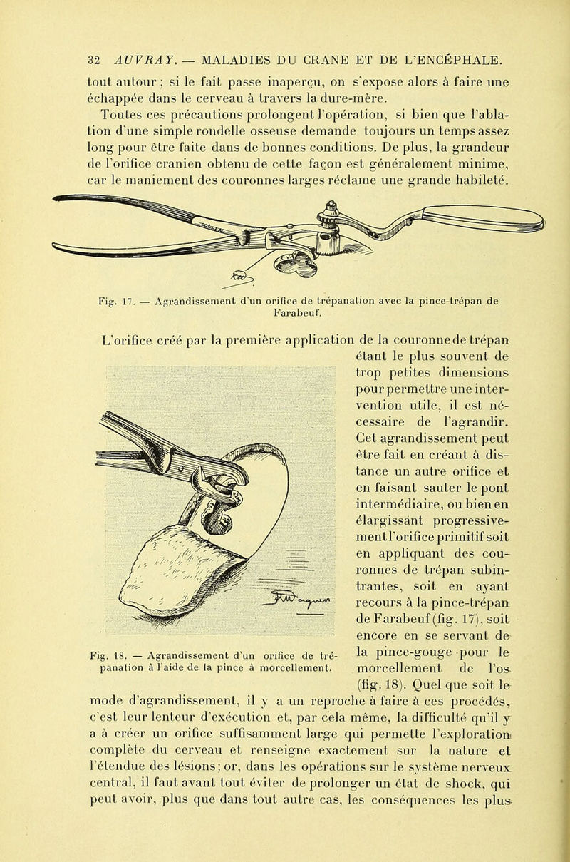 tout autour ; si le fait passe inaperçu, on s'expose alors à faire une échappée dans le cerveau à travers la dure-mère. Toutes ces précautions prolongent l'opération, si bien que l'abla- tion d'une simple rondelle osseuse demande toujours un temps assez long pour être faite dans de bonnes conditions. De plus, la grandeur de l'orifice crânien obtenu de cette façon est généralement minime, car le maniement des couronnes larges réclame une grande habileté. Fig. 17. — Agrandissement d'un orifice de trépanation avec la pince-trépan de Farabeut'. L'orifice créé par la première application de la couronne de trépan étant le plus souvent de trop petites dimensions pour permettre une inter- vention utile, il est né- cessaire de l'agrandir. Cet agrandissement peut être fait en créant à dis- tance un autre orifice et en faisant sauter le pont intermédiaire, ou bien en élargissant progressive- mentl'orifice primitif soit en appliquant des cou- ronnes de trépan subin- trantes, soit en ayant recours à la pince-trépaa de Farabeuf (fig. 17), soit encore en se servant de la pince-gouge pour le morcellement de l'os (fig. 18). Quel que soit le^ mode d'agrandissement, il y a un reproche à faire à ces procédés, c'est leur lenteur d'exécution et, par cela même, la difficulté qu'il y a à créer un orifice suffisamment large qui permette l'exploration complète du cerveau et renseigne exactement sur la nature et l'étendue des lésions; or, dans les opérations sur le système nerveux central, il faut avant tout éviter de prolonger un état de shock, qui peut avoir, plus que dans tout autre cas, les conséquences les plus- Fig. 18. — Agrandissement d'un orifice de tré- panalion à l'aide de la pince à morcellement.