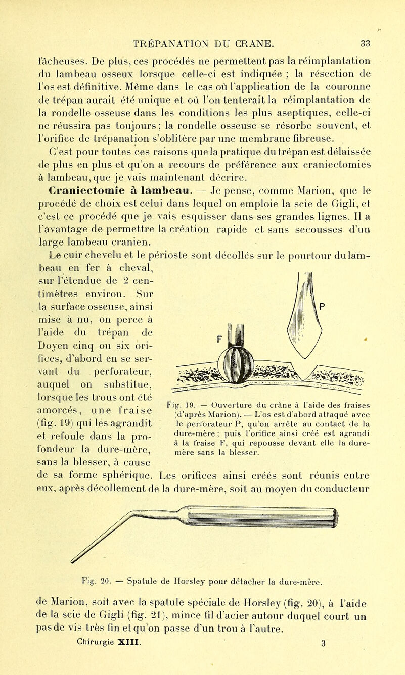 fâcheuses. De plus, ces procédés ne permettent pas la réimplantation du lambeau osseux loi'sque celle-ci est indiquée ; la résection de Tos est définitive. Même dans le cas où l'application de la couronne de trépan aurait été unique et où l'on tenterait la réimplantation de la rondelle osseuse dans les conditions les plus aseptiques, celle-ci ne réussira pas toujours ; la rondelle osseuse se résorbe souvent, et l'orifice de trépanation s'oblitère par une membrane fibreuse. C'est pour toutes ces raisons que la pratique du trépan est délaissée de plus en plus et qu'on a recours de préférence aux craniectomies à lambeau, que je vais maintenant décrire. Craniectomie à lambeau. — Je pense, comme Marion, que le procédé de choix est celui dans lequel on emploie la scie de Gigli, et c'est ce procédé que je vais esquisser dans ses grandes lignes. Il a l'avantage de permettre la création rapide et sans secousses d'un large lambeau crânien. Le cuir chevelu et le périoste sont décollés sur le pourtour du lam- beau en fer à cheval, sur l'étendue de 2 cen- timètres environ. Sur la surface osseuse, ainsi mise à nu, on perce à l'aide du trépan de Doyen cinq ou six ori- fices, d'abord en se ser- vant du perforateur, auquel on substitue, lorsque les trous ont été amorcés, une fraise (fig. 19) qui les agrandit et refoule dans la pro- fondeur la dure-mère, sans la blesser, à cause de sa forme sphérique. Les orifices ainsi créés sont réunis entre eux, après décollement de la dure-mère, soit au moyen du conducteur Fig. 19. — Ouverture du crâne à l'aide des fraises (d'après Marion). — L'os est d'abord attaqué avec le perlorateur P, qu'on arrête au contact de la dure-mère ; puis l'orifice ainsi créé est agrandi à la fraise F, qui repousse devant elle la dure- mère sans la blesser. Fig. 20. — Spatule de Horsley pour détacher la dure-mère. de Marion, soit avec la spatule spéciale de Horsley (fig. 20), à l'aide de la scie de Gigli (fig. 21), mince fil dacier autour duquel court un pas de vis très fin etqu on passe d'un trou à l'autre. Chirurgie XIII. ' 3
