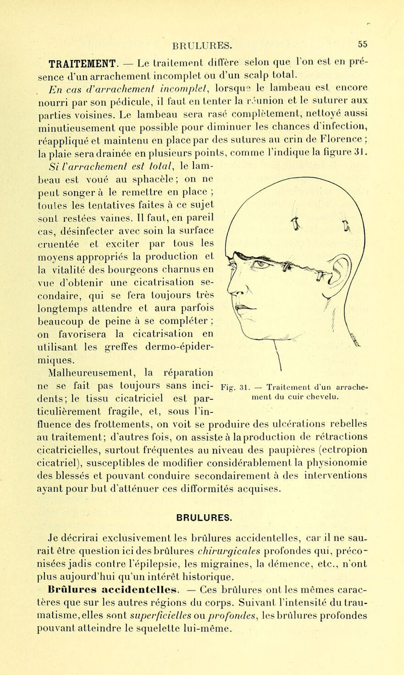 TRAITEMENT. — Le traitement dilTère selon que Ton est en pré- sence d'un tu-rachement incomplet ou d'un scalp total. En cas d'arrachemenl incomplet, lorsqu'^ le lambeau est encore nourri par son pédicule, il faut en tenter la r/'union et le suturer aux parties voisines. Le lambeau sera rasé complètement, nettoyé aussi minutieusement que possible pour diminuer les chances d'infection, réappliqué et maintenu en place par des sutures au crin de Florence ; la plaie sera drainée en plusieurs points, comme l'indique la figure 31. Si rarrachement est total, le lam- beau est voué au sphacèle ; on ne peut songera le remettre en place ; toutes les tentatives faites à ce sujet sont restées vaines. Il faut, en pareil cas, désinfecter avec soin la surface cruentée et exciter par tous les moyens appropriés la production et la vitalité des bourgeons charnus en vue d'obtenir une cicatrisation se- condaire, qui se fera toujours très longtemps attendre et aura parfois beaucoup de peine à se compléter ; on favorisera la cicatrisation en utilisant les greffes dermo-épider- miques. Malheureusement, la réparation ne se fait pas toujours sans inci- dents; le tissu cicatriciel est par- ticulièrement fragile, et, sous l'in- fluence des frottements, on voit se produire des ulcérations rebelles au traitement; d'autres fois, on assiste à la production de rétractions cicatricielles, surtout fréquentes au niveau des paupières (ectropion cicatriel), susceptibles de modifier considérablement la physionomie des blessés et pouvant conduire secondairement à des interventions ayant pour but d'atténuer ces difformités acquises. Fig. 31. — Traitement d'un arrache- ment du cuir chevelu. BRULURES. Je décrirai exclusivement les brûlures accidentelles, car il ne sau- rait être question ici des brûlures chirurgicales profondes qui, préco- nisées jadis contre l'épilepsie, les migraines, la démence, etc., n'ont plus aujourd'hui qu'un intérêt historique. Brûlures accidentelles. — Ces brûlures ont les mêmes carac- tères que sur les autres régions du corps. Suivant l'intensité du trau- matisme, elles sont superficielles ou profondes, les brûlures profondes pouvant atteindre le squelette lui-même.