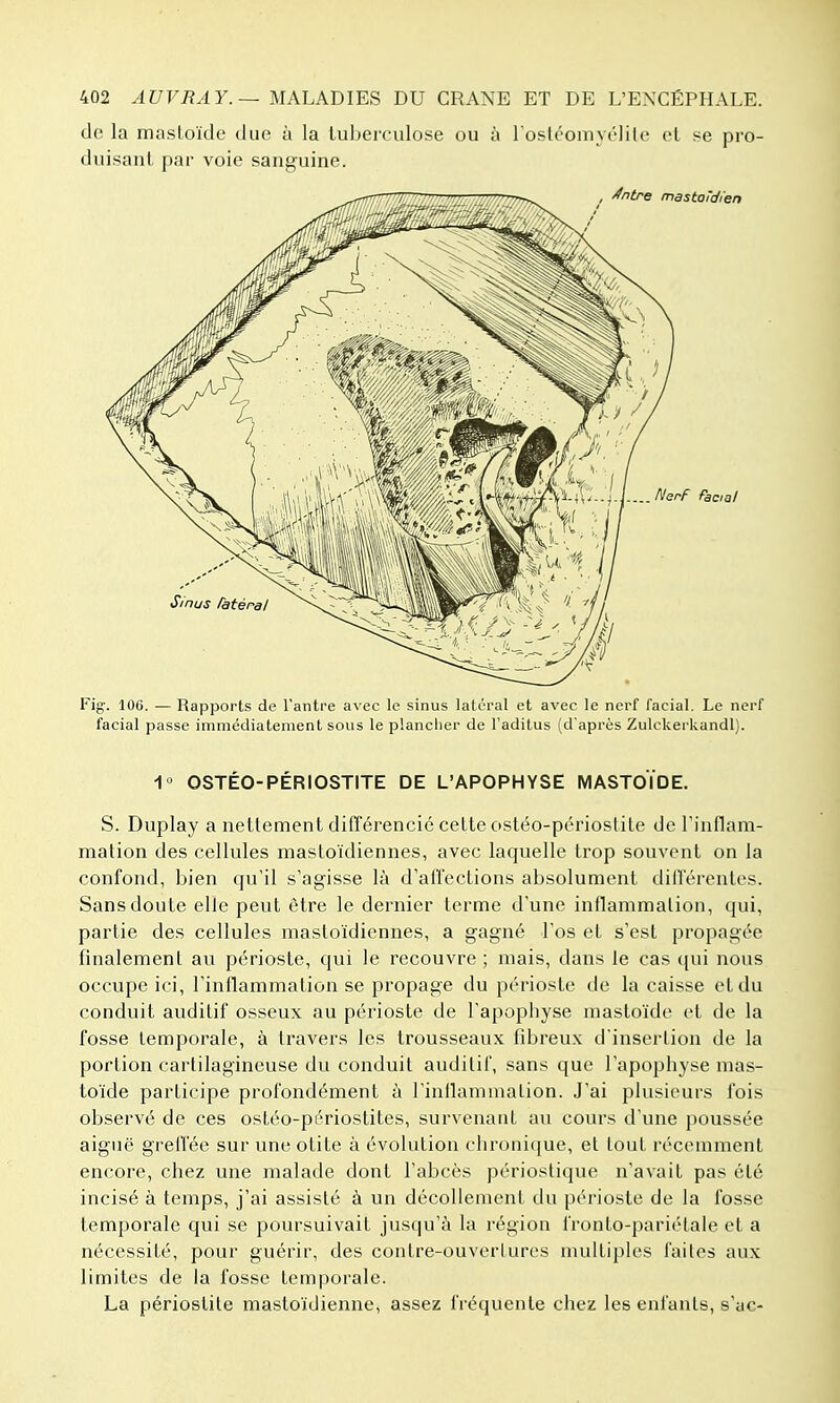 de la masloïde due à la tuberculose ou à l oslcomyrlite et se pro- duisant par voie sanguine. Fig-. 106. — Rapports de l'antre avec le sinus latéral et avec le nerf facial. Le nerf facial passe immédiatement sous le planclier de l'aditus (d'après Zulckerkandl). 1 OSTÉO-PÉRIOSTITE DE L'APOPHYSE MASTOÏDE. S. Duplay a nettement différencié celte ostéo-périoslite de Tinflam- mation des cellules mastoïdiennes, avec laquelle trop souvent on la confond, bien qu'il s'agisse là d'affections absolument dilTérenles. Sans doute elle peut être le dernier terme d'une inflammation, qui, partie des cellules mastoïdiennes, a gagné l'os et s'est propagée finalement au périoste, qui le recouvre ; niais, dans le cas qui nous occupe ici, l'inflammation se propage du périoste de la caisse et du conduit auditif osseux au périoste de l'apophyse mastoïde et de la fosse temporale, à travers les trousseaux fibreux d'insertion de la portion cartilagineuse du conduit auditif, sans que l'apophyse mas- to'ide participe profondément à l'inllammaLion. J'ai plusieurs fois observé de ces ostéo-périostites, survenant au cours d'une poussée aiguë grelfée sur une otite à évolution chronique, et tout récemment encore, chez une malade dont l'abcès périostique n'avait pas été incisé à temps, j'ai assisté à un décollement du périoste de la fosse temporale qui se poursuivait jusqu'à la région fronto-pariélale et a nécessité, pour guérir, des contre-ouvcriures multiples faites aux limites de la fosse temporale. La périostite mastoïdienne, assez fréquente chez les enfants, s'ac-