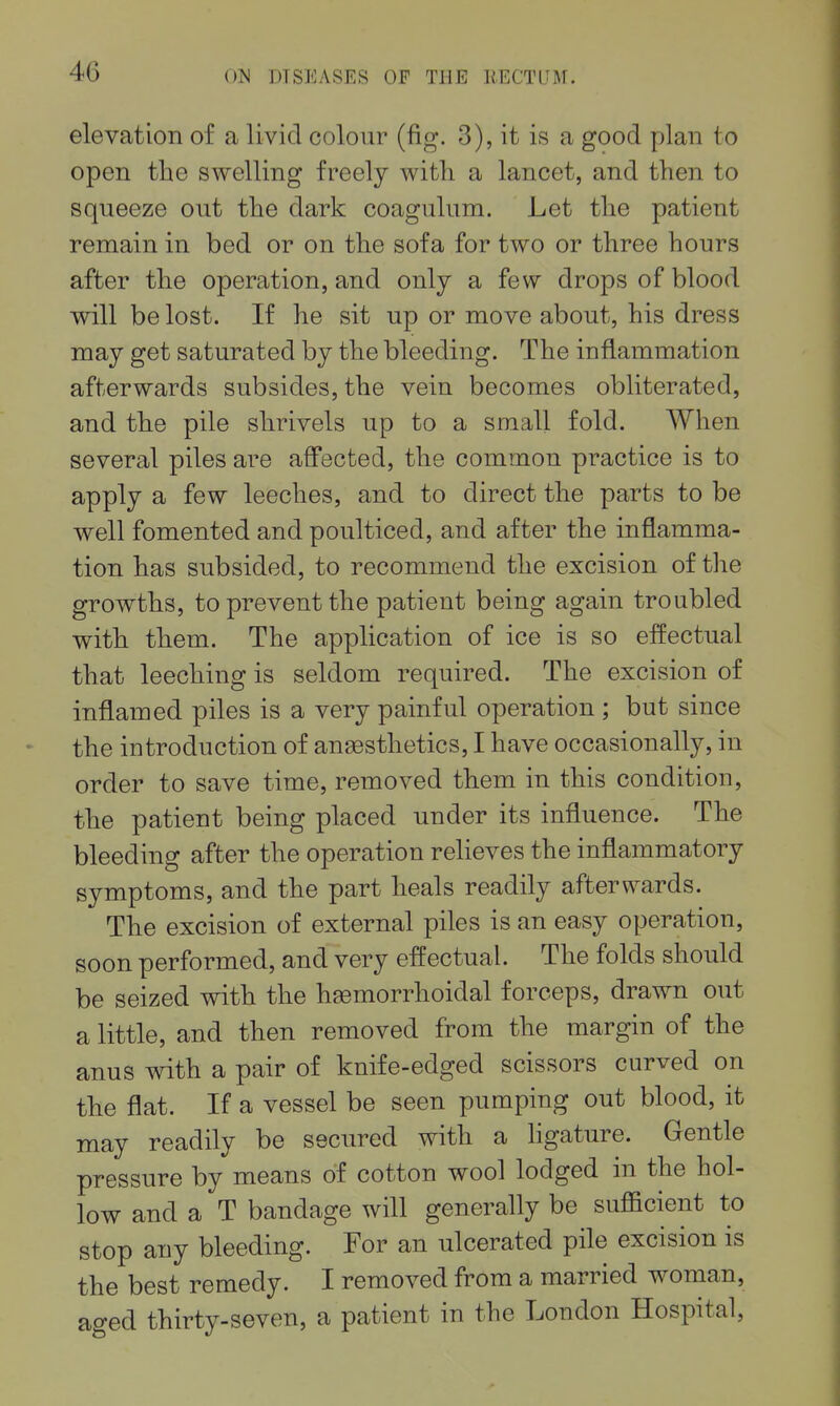 elevation of a livid colour (fig. 3), it is a good plan to open the swelling freely with a lancet, and then to squeeze out the dark coagulum. Let the patient remain in bed or on the sofa for two or three hours after the operation, and only a few drops of blood will be lost. If he sit up or move about, his dress may get saturated by the bleeding. The inflammation afterwards subsides, the vein becomes obliterated, and the pile shrivels up to a small fold. When several piles are affected, the common practice is to apply a few leeches, and to direct the parts to be well fomented and poulticed, and after the inflamma- tion has subsided, to recommend the excision of the growths, to prevent the patient being again troubled with them. The application of ice is so effectual that leeching is seldom required. The excision of inflamed piles is a very painful operation ; but since the introduction of angesthetics, I have occasionally, in order to save time, removed them in this condition, the patient being placed under its influence. The bleeding after the operation reheves the inflammatory symptoms, and the part heals readily afterwards. The excision of external piles is an easy operation, soon performed, and very effectual. The folds should be seized with the hsemorrhoidal forceps, drawn out a little, and then removed from the margin of the anus with a pair of knife-edged scissors curved on the flat. If a vessel be seen pumping out blood, it may readily be secured with a hgature. Gentle pressure by means of cotton wool lodged in the hol- low and a T bandage will generally be sufficient to stop any bleeding. For an ulcerated pile excision is the best remedy. I removed from a married woman, aged thirty-seven, a patient in the London Hospital,