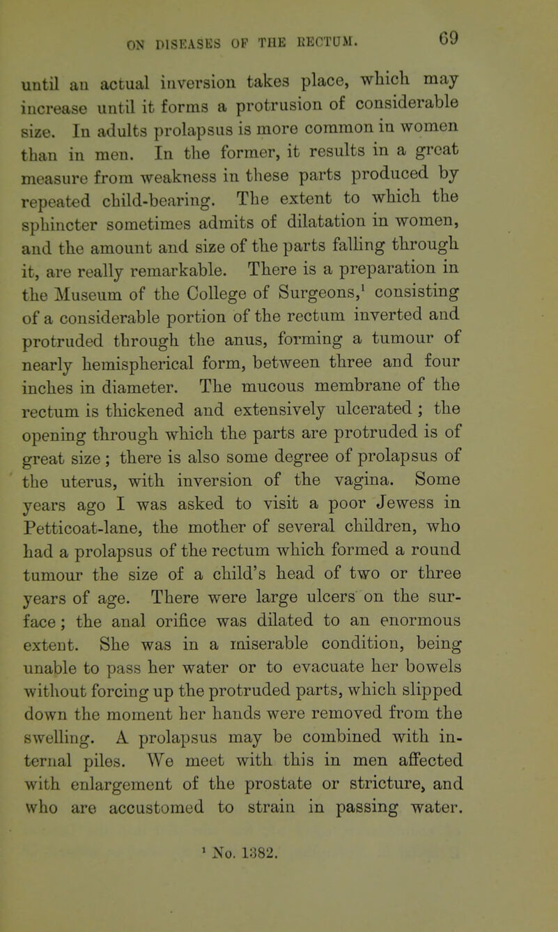 until au actual iuversiou takes place, which may increase until it forms a protrusion of considerable size. In adults prolapsus is more common in women than in men. In the former, it results in a great measure from weakness in these parts produced by repeated child-bearing. The extent to which the sphincter sometimes admits of dilatation in women, and the amount and size of the parts faUing through it, are really remarkable. There is a preparation in the Museum of the College of Surgeons,^ consisting of a considerable portion of the rectum inverted and protruded through the anus, forming a tumour of nearly hemispherical form, between three and four inches in diameter. The mucous membrane of the rectum is thickened and extensively ulcerated ; the opening through which the parts are protruded is of great size; there is also some degree of prolapsus of the uterus, with inversion of the vagina. Some years ago I was asked to visit a poor Jewess in Petticoat-lane, the mother of several children, who had a prolapsus of the rectum which formed a round tumour the size of a child's head of two or three years of age. There were large ulcers on the sur- face ; the anal orifice was dilated to an enormous extent. She was in a miserable condition, being unable to pass her water or to evacuate her bowels without forcing up the protruded parts, which slipped down the moment her hands were removed from the swelling. A prolapsus may be combined with in- ternal piles. We meet with this in men affected with enlargement of the prostate or stricture, and who are accustomed to strain in passing water. ' No. 1:582.