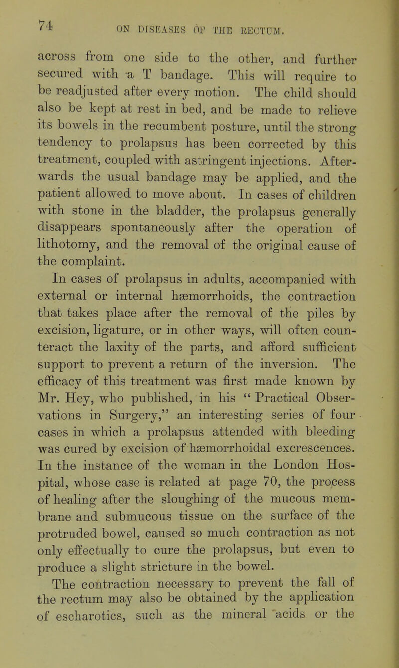across from one side to tlie otlier, and further secured with a T bandage. This will require to be readjusted after every motion. The child should also be kept at rest in bed, and be made to relieve its bowels in the recumbent posture, until the strong tendency to prolapsus has been corrected by this treatment, coupled with astringent injections. After- wards the usual bandage may be applied, and the patient allowed to move about. In cases of children with stone in the bladder, the prolapsus generally disappears spontaneously after the operation of lithotomy, and the removal of the original cause of the complaint. In cases of prolapsus in adults, accompanied with external or internal haemorrhoids, the contraction that takes place after the removal of the piles by excision, ligature, or in other ways, will often coun- teract the laxity of the parts, and afford sufficient support to prevent a return of the inversion. The efficacy of this treatment was first made known by Mr. Hey, who published, in his  Practical Obser- vations in Surgery, an interesting series of four cases in which a prolapsus attended with bleeding was cured by excision of haemorrhoidal excrescences. In the instance of the woman in the London Hos- pital, whose case is related at page 70, the process of healing after the sloughing of the mucous mem- brane and submucous tissue on the surface of the protruded bowel, caused so much contraction as not only effectually to cure the prolapsus, but even to produce a slight stricture in the bowel. The contraction necessary to prevent the fall of the rectum may also be obtained by the appHcation of escharotics, such as the mineral acids or the