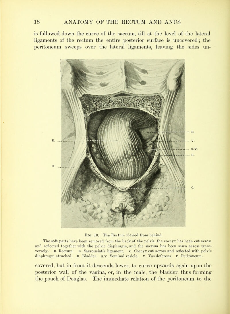 is followed down the curve of the sacrum, till at the level of the lateral ligaments of the rectum the entire posterior surface is uncovered; the peritoneum sweeps over the lateral ligaments, leaving the sides un- FiG. 10. The Rectum viewed from behind. The soft parts have been removed from the back of the pelvis, the coccyx has been cut across and reflected together with the pelvic diaphragm, and the sacrum has been sawn across trans- versely. R. Rectum, s. Sacro-sciatic ligament, c. Coccyx cut across and reflected with pelvic diaphragm attached, b. Bladder, s.v. Seminal vesicle, v. Vas deferens. P. Peritoneum. covered, but in front it descends lower, to curve upwards again upon the posterior wall of the vagina, or, in the male, the bladder, thus forming the pouch of Douglas. The immediate relation of the peritoneum to the