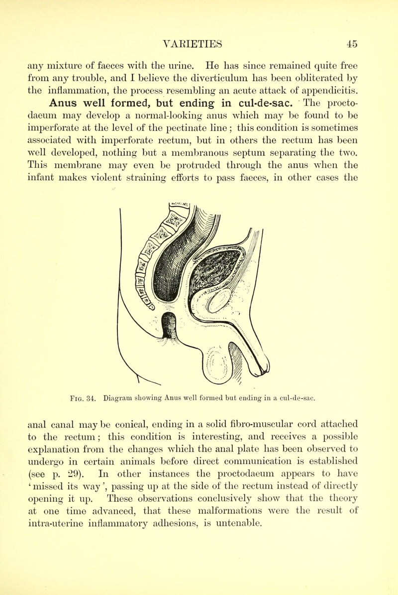 any mixture of faeces with the urine. He has since remained quite free from any trouble, and I believe the diverticulum has been obliterated by the inflammation, the process resembling an acute attack of appendicitis. Anus well formed, but ending in cul-de-sac. The procto- daeum may develop a normal-looking anus which may be found to be imperforate at the level of the pectinate line ; this condition is sometimes associated with imperforate rectum, but in others the rectum has been well developed, nothing but a membranous septum separating the two. This membrane may even be protruded through the anus when the infant makes violent straining efforts to j)ass faeces, in other cases the Fig. 34. Diagram showing Anus well formed but ending in a cul-de-sac. anal canal may be conical, ending in a solid fibro-muscular cord attached to the rectum; this condition is interesting, and receives a possible explanation from the changes which the anal plate has been observed to undergo in certain animals before direct communication is established (see p. 29). In other instances the proctodaeum appears to have ' missed its way ', passing up at the side of the rectum instead of directly opening it up. These observations conclusively show that the theory at one time advanced, that these malformations were the result of intra-uterine inflammatory adhesions, is untenable.