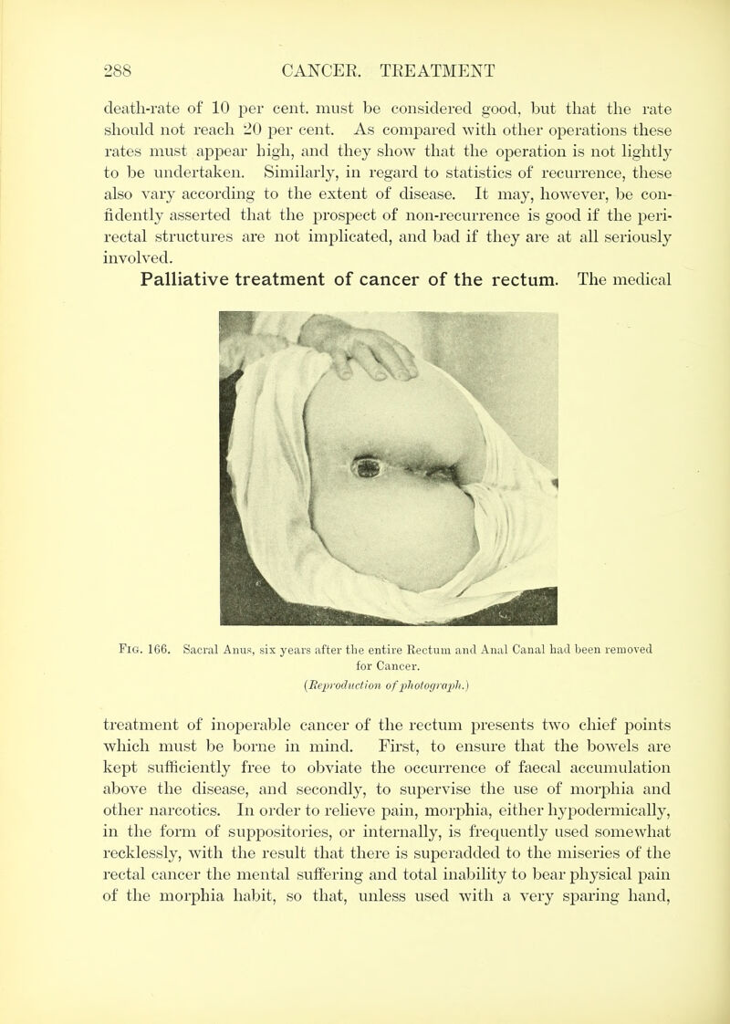 death-rate of 10 per cent, must be considered good, but that the rate should not reach 20 per cent. As compared with other operations these rates must appear high, and they show that the operation is not hghtly to be undertaken. Similarly, in regard to statistics of recurrence, these also vary according to the extent of disease. It may, however, be con- fidently asserted that the i3rospect of non-recurrence is good if the peri- rectal structures are not implicated, and bad if they are at all seriously involved. Palliative treatment of cancer of the rectum. The medical Fig. 166. Sacral Anns, six years after the entire Rectum and Anal Canal bad been removed for Cancer. [Eeproductioii ofphotogiV])h ■) treatment of inoperable cancer of the rectum presents two chief points which must be borne in mind. First, to ensure that the bowels are kept sufficiently free to obviate the occurrence of faecal accumulation above the disease, and secondly, to supervise the use of morphia and other narcotics. In order to relieve pain, morphia, either hypodermically, in the form of suj)positories, or internally, is frequently used somewhat recklessly, with the result that there is superadded to the miseries of the rectal cancer the mental suffering and total inability to bear physical pain of the morphia habit, so that, unless used with a very sparing hand.