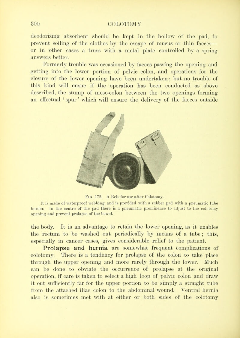 deodorizing absorbent should be kept in the hollow of the pad, to prevent soiling of the clothes by the escape of mucus or thin faeces— or in other cases a truss with a metal plate controlled by a spring answers better. Formerly trouble Avas occasioned by faeces passing the opening and getting into the lower portion of pelvic colon, and operations for the closure of the lower opening have been undertaken; but no trouble of this kind will ensue if the operation has been conducted as above described, the stump of meso-colon between the two openings forming an effectual ' spur' which will ensure the delivery of the faeces outside Fig. 172. A Belt for use after Colotoniy. It is made of waterproof webbing, and is provided with a rubber pad with a pneumatic tube border. In the centre of the pad there is a pneumatic prominence to adjust to the colotomy opening and prevent prohipse of the bowel. the body. It is an advantage to retain the lower opening, as it enables the rectum to be washed out periodically by means of a tube; this, especially in cancer cases, gives considerable relief to the patient. Prolapse and hernia are somewhat frequent complications of colotomy. There is a tendency for prolapse of the colon to take place through the upper opening and more rarely through the lower. Much can be done to obviate the occurrence of prolapse at the original operation, if care is taken to select a high loop of pelvic colon and draw it out sufficiently far for the upper portion to be simply a straight tube from the attached iliac colon to the abdominal wound. Ventral hernia also is sometimes met with at either or both sides of the colotomy /