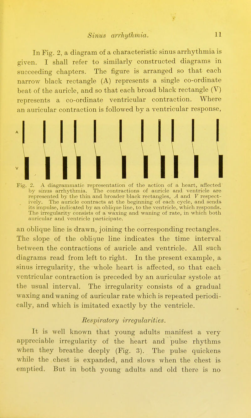 In Fig. 2, a diagram of a characteristic sinus arrhythmia is given. I shall refer to similarly constructed diagrams in succeeding chapters. The figure is arranged so that each narrow black rectangle (A) represents a single co-ordinate beat of the auricle, and so that each broad black rectangle (V) represents a co-ordinate ventricular contraction. Where an auricular contraction is followed by a ventricular response, Fig. 2. A diagrammatic representation of the action of a heart, affected by sinus arrhythmia. The contractions of auricle and ventricle are represented by the thin and broader black rectangles, A and V respect- ively. The auricle contracts at the beginning of each cycle, and sends its impulse, indicated by an oblique line, to the ventricle, which responds. The irregularity consists of a waxing and waning of rate, in which both auricular and ventricle participate. an oblique line is drawn, joining the corresponding rectangles. The slope of the oblique line indicates the time interval between the contractions of auricle and ventricle. All such diagrams read from left to right. In the present example, a sinus irregularity, the whole heart is affected, so that each ventricular contraction is preceded by an auricular systole at the usual interval. The irregularity consists of a gradual waxing and waning of auricular rate which is repeated periodi- cally, and which is imitated exactly by the ventricle. Respiratory irregularities. It is well known that young adults manifest a very appreciable irregularity of the heart and pulse rhythms when they breathe deeply (Fig, 3). The pulse quickens while the chest is expanded, and slows when the chest is emptied. But in both young adults and old there is no