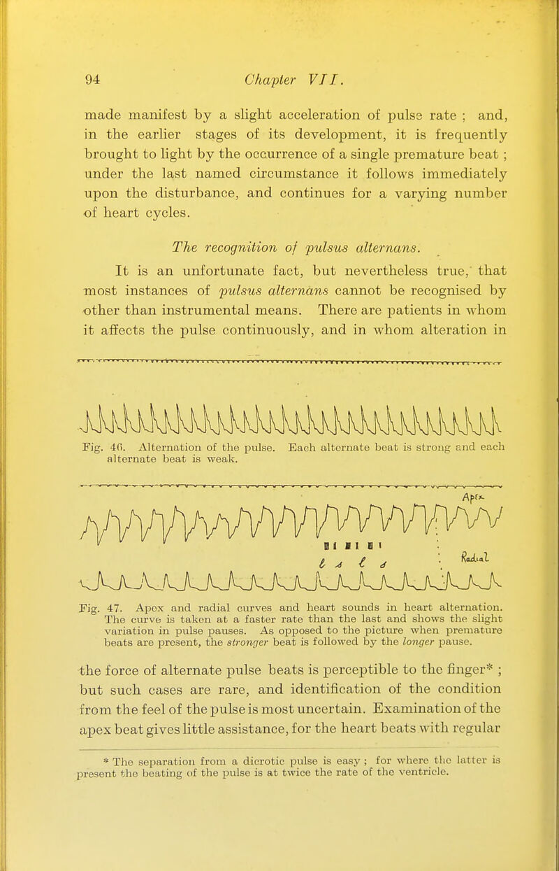 made manifest by a slight acceleration of pulse rate ; and, in the earlier stages of its development, it is frequently brought to light by the occurrence of a single premature beat ; under the last named circumstance it follows immediately upon the disturbance, and continues for a varying number of heart cycles. The recognition of pulsus alternans. It is an unfortunate fact, but nevertheless true,' that most instances of pulsus alternans cannot be recognised by other than instrumental means. There are patients in whom it affects the pulse continuovisly, and in whom alteration in Fig. -Ifi. Alternation of the pulse, alternate beat is weak. Each alternate beat is strong and each B 1 I I B I ^ i (f ' '^'^'^ Fig. 47. Apex and radial curves and heart sounds in heart alternation. The curve is taken at a faster rate than the last and shows tlie slight variation in pulse pauses. As opposed to the picture when premature beats are iDresent, the stronger beat is followed by the longer pause. the force of alternate pulse beats is perceptible to the finger* ; but such cases are rare, and identification of the condition from the feel of the pulse is most uncertain. Examination of the apex beat gives little assistance, for the heart beats with regular * The separation from a dicrotic pulse is easy ; for where the latter is present the beating of the pulse is at twice the rate of tlie ventricle.