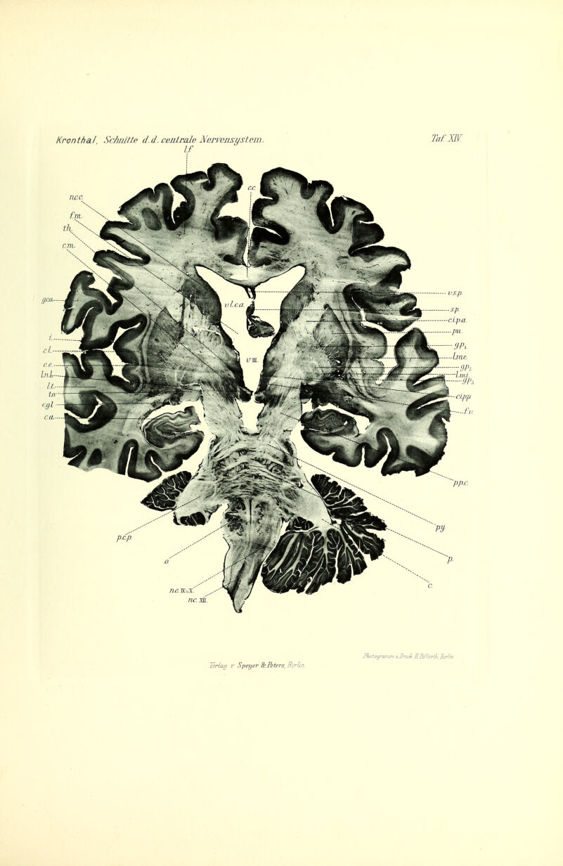 Kronthai ScJmüte d.d. ceniraJe iVervensi/siem. Taf ILV. U Photogravurp. ujruck EBiffnrik, Berlin