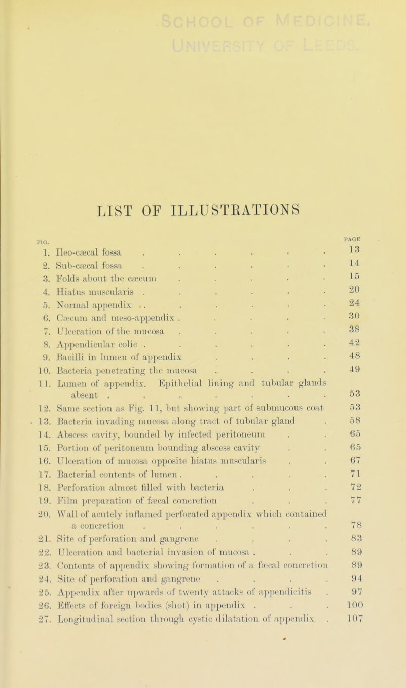 LIST OF ILLUSTRATIONS HO. PA0K 1. Ileo-caecal fossa . . . • . . 13 2. Sub-caical fossa . . . . • .14 3. Folds about the caecum . . ■ • .15 4. Hiatus muscularis 20 5. Normal appendix «. . . • • .24 (>. Caecum and meso-appendix . . . • .30 7. Ulceration of the mucosa . . . ■ .38 8. Appendicular colic 42 9. Bacilli in lumen of appendix . . . .48 10. Bacteria penet j-ating the mucosa . . . .49 11. Lumen of appendix. Epithelial lining and tubular glands absent . *, . . .53 I •>. Same section as Fig. LI, but showing part of submucous coat 53 13. Bacteria invading mucosa along tract of tubular gland . 58 14. Absceas cavity, bounded by infected peritoneum . . 65 If). Portion of peritoneum bounding abscess cavity . . 65 If;. Ulceration of mucosa opposite hiatus muscularis . . 67 17. Bacterial contents of lumen . . . . .71 18. Perforation almost- tilled with bacteria . . .72 t9. Film preparation of faecal concretion . . .77 l'm Wall of acutely inflamed perforated appendix which contained a concretion ...... 78 21. Site of perforation and gangrene . . . .83 22. Ulceration and bacterial invasion of mucosa. . . 89 23. Contents of appendix showing formation of a faecal concretion 89 24. Site of perforation and gangrene . . . .94 25. Appendix after upwards of twenty attacks of appendicitis . i>7 26. Effects of foreign bodies ('shot) in appendix . . . 100 27. Longitudinal section through cystic dilatation of appendix 107