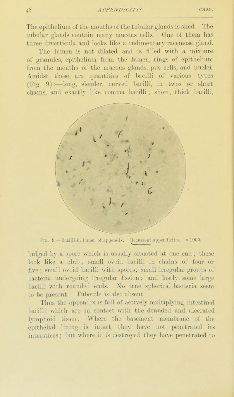 The epithelium of the mouths of t he tubular glands is shed. The tubular glands contain many mucous cells. One of them has three diverticula and looks like a rudimentary racemose gland. The lumen is not dilated and is tilled with a mixture of granules, epithelium from the lumen, rings of epithelium from the mouths of the mucous glands, pus cells, and nuclei. Amidst these, are quantities of bacilli of various types (Fig. 0):—long, slender, curved bacilli, in twos or short chains, and exactly like (/omnia bacilli; short, thick bacilli, Fig. !». Bacilli iu lumen of appendix. Recurrent appendicitis, x 1000. • 1 bulged by a spore which is usually situated at one end: these look like a club; small ovoid bacilli in chains of four or five; small ovoid bacilli with spores; small irregular groups of bacteria undergoing irregular fission ; and lastly, some large bacilli with rounded ends. No true spherica] bacteria seem to be present. Tubercle is also absent. Thus the appendix is full of actively multiplying intestinal bacilli, which are in contact with tin' denuded and ulcerated lymphoid tissue. W'here the basement membrane of the epithelial lining is intact, they have not penetrated its interstice's: but where it is destroyed, they have penetrated to