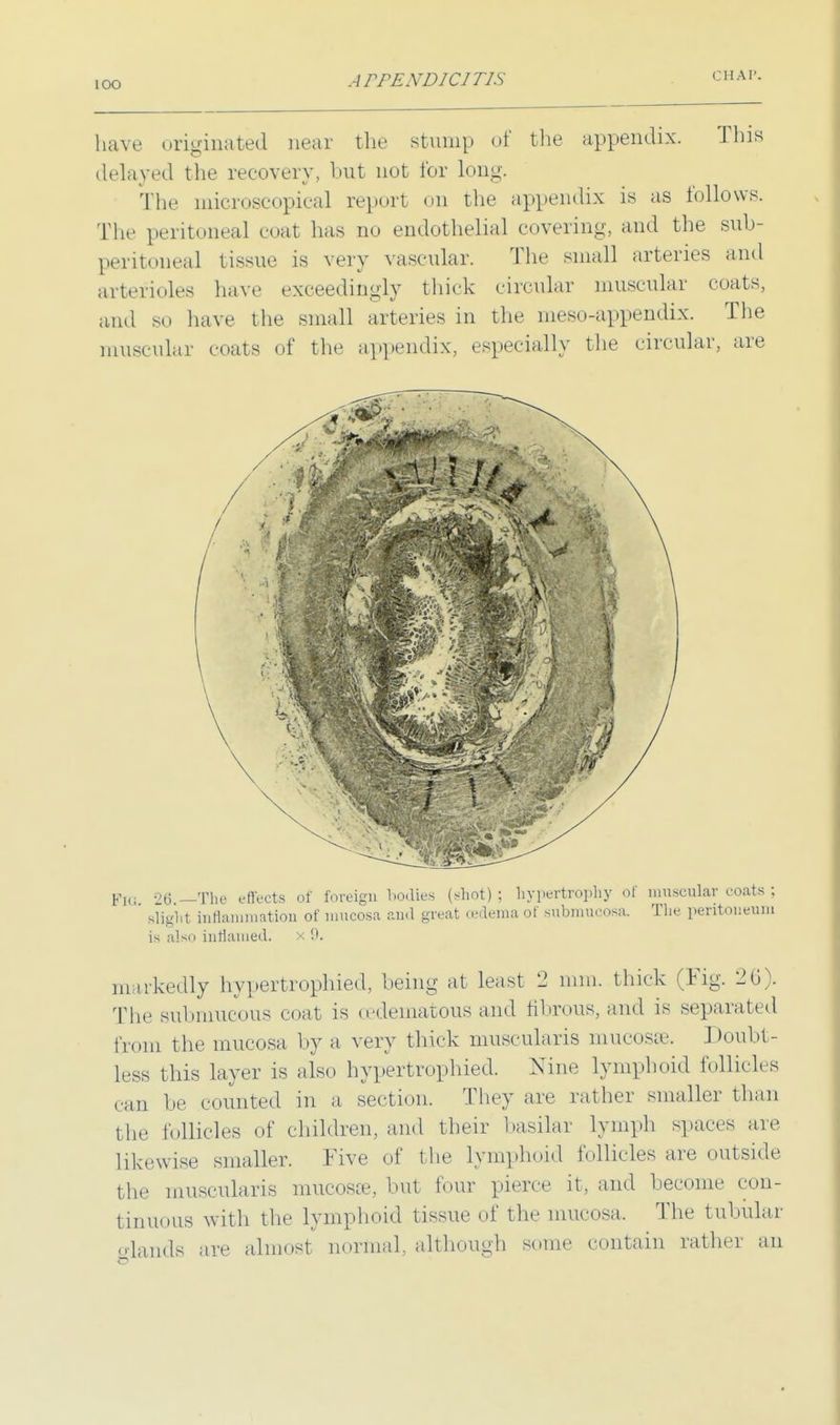 IOO have originated near the stump of the appendix. This delayed the recovery, but not for long. The microscopical report on the appendix is as follows. The peritoneal coat has no endothelial covering, and the sub- peritoneal tissue is very vascular. The small arteries and arterioles have exceedingly thick circular muscular coats, and so have the small arteries in the meso-appendix. The muscular coats of the appendix, especially the circular, are p1Q 26 —The effects of foreign bodies (shot) ; hypertrophy of muscular coats ; Blight inflammation of mucosa and great (Edema of submucosa. The peritoneum is also inflamed. x 9. markedly hypertrophied, being at least 2 mm. thick (Fig. 26). The submucous coat is (edematous and fibrous, and is separated from the mucosa by a very thick muscularis mucosae. Doubt- less this layer is also hypertrophied. Nine lymphoid follicles can be counted in a section. They are rather smaller than the follicles of children, and their basilar lymph spaces are likewise smaller. Five of the lymphoid follicles are outside the muscularis mucosae, but four pierce it, and become con- fcinuous with the lymphoid tissue of the mucosa. The tubular glands are almost normal, although some contain rather an