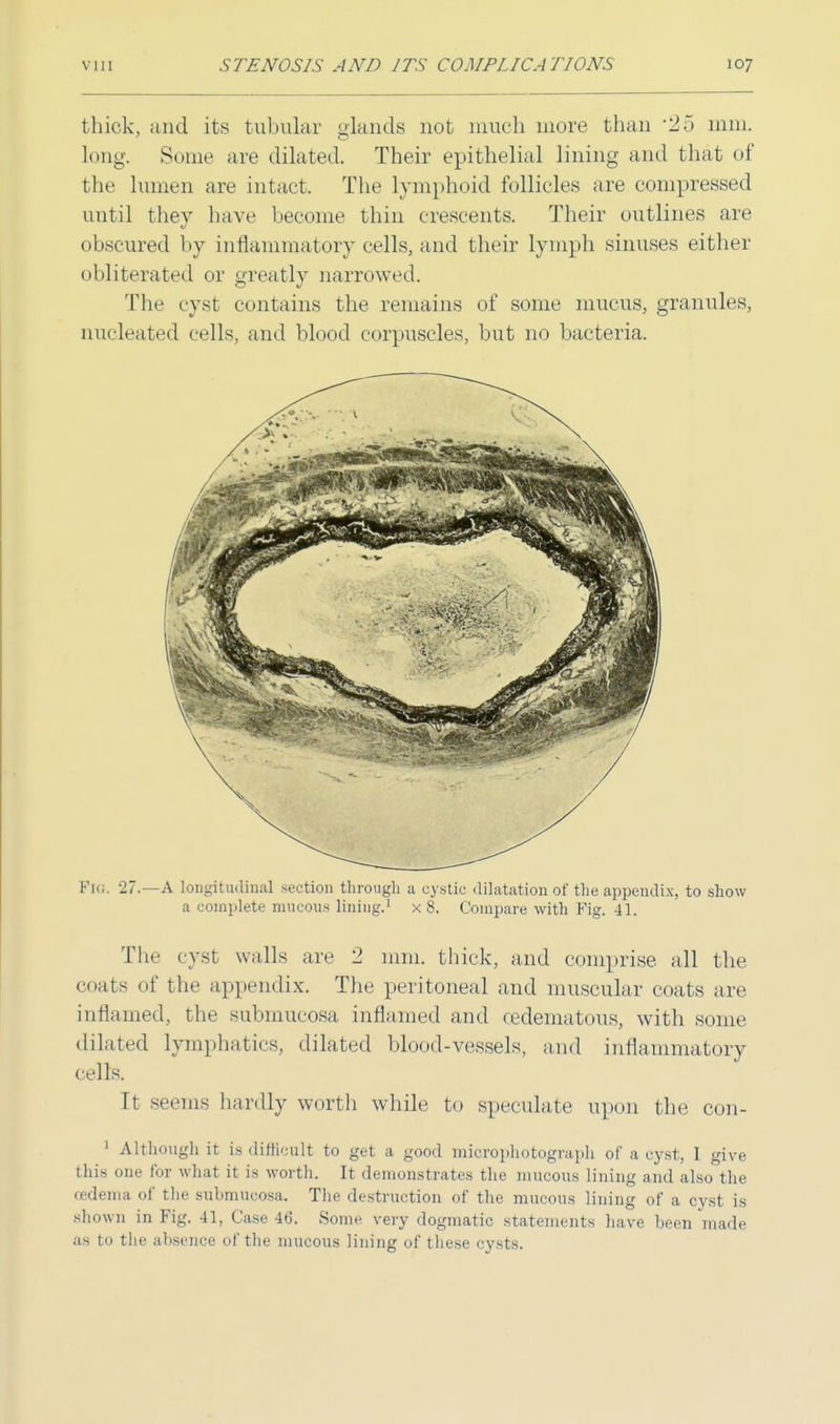 thick, and its tubular glands not much more than '25 mm. long. Some are dilated. Their epithelial lining and that of the lumen are intact. The lymphoid follicles are compressed until they have become thin crescents. Their outlines are obscured by inflammatory cells, and their lymph sinuses either obliterated or greatly narrowed. The cyst contains the remains of some mucus, granules, nucleated cells, and blood corpuscles, but no bacteria. FlG. 27.—A longitudinal section through a cystic dilatation of the appendix, to show a complete mucous lining.1 x 8. Compare with Fig. 41. The cyst walls are 2 mm. thick, and comprise all the coats of the appendix. The peritoneal and muscular coats are inflamed, the submucosa inflamed and cedematous, with some dilated lymphatics, dilated blood-vessels, and inflammatory cells. It seems hardly worth while to speculate upon the con- 1 Although it is difficult to get a good microphotograph of a cyst, I give this one for what it is worth. It demonstrates the mucous lining and also the oedema of the submucosa. The destruction of the mucous lining of a cyst is .shown in Fig. 41, Case 46. Some very dogmatic statements have been made as to the absence of the mucous lining of these cysts.