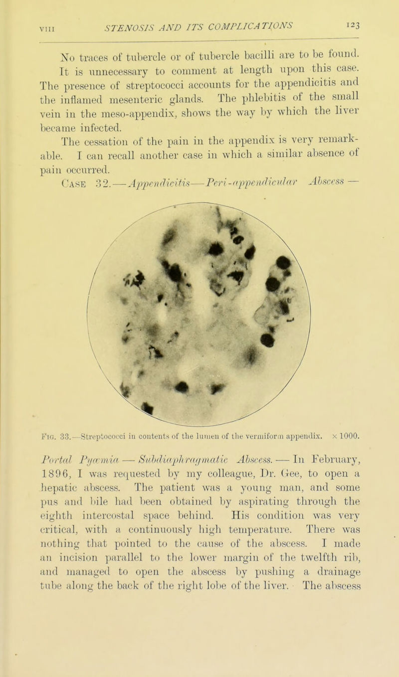 3STo traces of tubercle or of tubercle bacilli are to be found. It is unnecessary to comment at length upon this case. The presence of streptococci accounts for the appendicitis and the inflamed mesenteric glands. The phlebitis of the small vein in the mes<.-appendix, shows the way by which the liver became infected. The cessation of the pain in the appendix is very remark- able. [ can recall another case in which a similar absence of pain occurred. Case -°>2.—Appendicitis—Peri-appendicular Abscess — Fig. 33.—Streptococci in contents of the lumen of the vermiform appendix, x 1000. Portal Pyaemia — Subdiaphragmatic Abscess. — In February, 1806, I was requested by my colleague, Dr. G-ee, to open a hepatic abscess. The patient was a young man, and some pus and bile had been obtained by aspirating through the eighth intercostal space behind. His condition was very critical, with a continuously high temperature. There was nothing that pointed to the cause of the abscess. I made an incision parallel to the lower margin of the twelfth rib, and managed to open the abscess by pushing a drainage tube along the back of the right lobe of the liver. The abscess