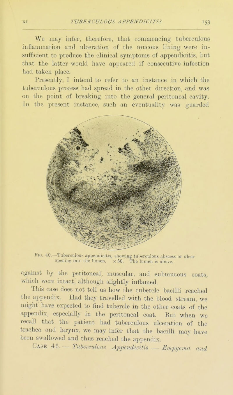 We may infer, therefore, that commencing tuberculous inflammation and ulceration of the mucous lining were in- sufficient to produce the clinical symptoms of appendicitis, hut that the latter would have appeared if consecutive infection had taken place. Presently, I intend to refer to an instance in which the tuberculous process had spread in the other direction, and was on the point of breaking into the general peritoneal cavity. In the present instance, such an eventuality was guarded Km;. -JO.—Tuberculous appendicitis, showing tuberculous abscess or ulcer opening into the lumen. x 50. The lumen is above. against by the peritoneal, muscular, and submucous coats, which were intact, although slightly inflamed. This ease does not tell us how the tubercle bacilli reached the appendix. Had they travelled with the blood stream, we might have expected to find tubercle in the other coats of the appendix, especially in the peritoneal coat, But when we recall that the patient had tuberculous ulceration of the trachea and larynx, we may infer that the bacilli may have been swallowed and thus reached the appendix. Case 40. — Tuberculous Appendicitis — Empyema and