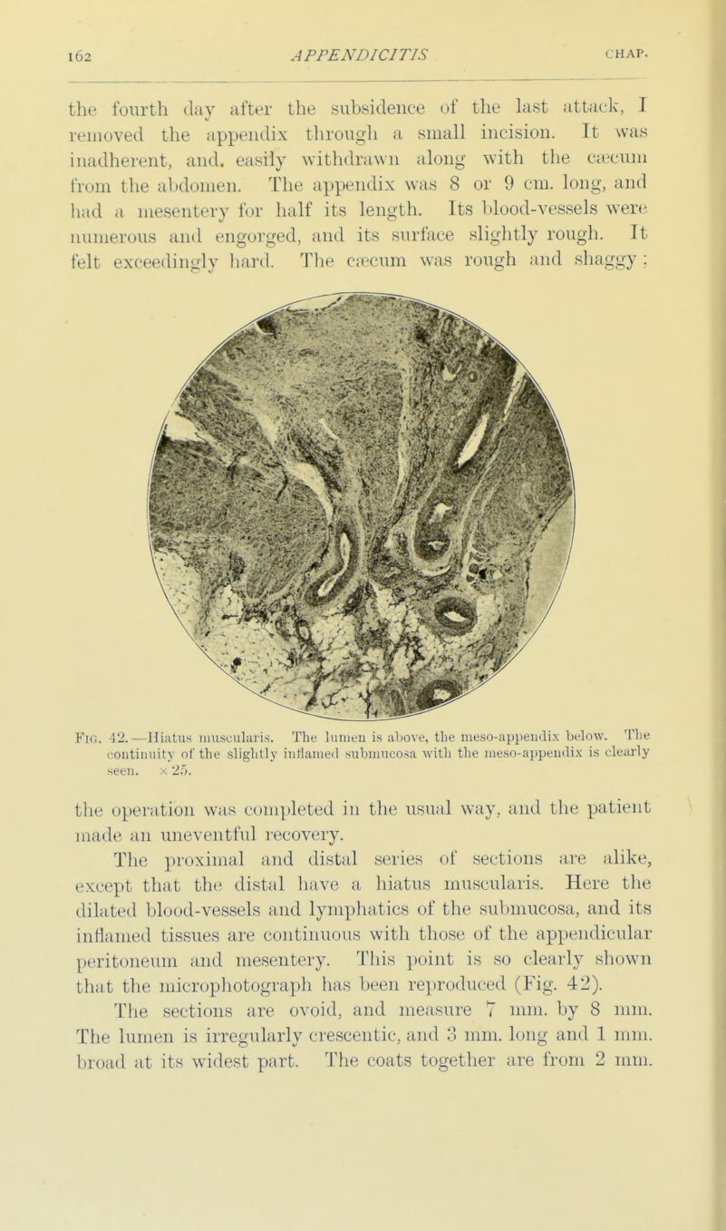 the fourth day after the subsidence of the last attack, I removed the appendix through a small incision. It was inadherent, and. easily withdrawn along with the caecum from the abdomen. The appendix was 8 or 9 cm. long, and had a mesentery for half its length. Its blood-vessels were numerous and engorged, and its surface slightly rough. It felt exceedingly hard. The csecum was rough and shaggy ; Fig. 42.—Hiatus muscularis. The lumen is above, the meso-appendix below. The continuity of the slightly inflamed submucosa with the meso-appendix is clearly seen, x 25. the operation was completed in the usual way. and the patient made an uneventful recovery. The proximal and distal series of sections are alike, except that the distal have a hiatus muscularis. Here the dilated blood-vessels and lymphatics of the submucosa, and its inflamed tissues are continuous with those of the appendicular peritoneum and mesentery. This point is so clearly shown that the mierophotograph has been reproduced (Fig. 42). The sections are ovoid, and measure 7 mm. by 8 mm. The lumen is irregularly crescentic, and 3 mm. long and 1 mm. broad at its widest part. The coats together are from 2 mm.