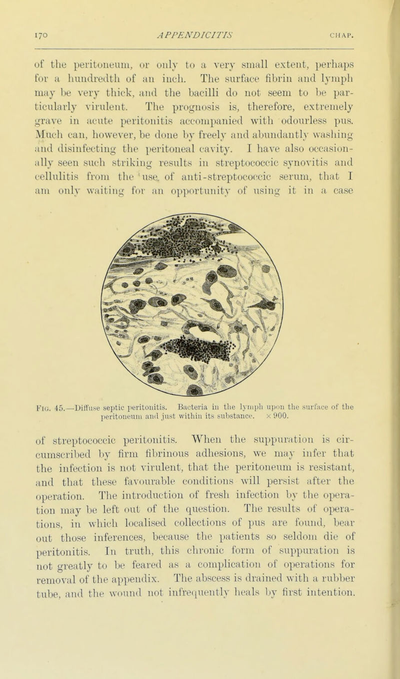 of the peritoneum, or only to a very small extent, perhaps for a hundredth of an inch. The surface fibrin and lymph may be very thick, and the bacilli do not seem to be par- ticularly virulent. The prognosis is, therefore, extremely grave in acute peritonitis accompanied with odourless pus. Much can, however, be done by freely and abundantly washing and disinfecting the peritoneal cavity. I have also occasion- ally seen such striking results in streptococcic synovitis and cellulitis from the use of anti-streptococcic serum, that I am only waiting for an opportunity of using it in a case Fiti. 45.—Diffuse septic peritonitis. Bacteria in the lymph upon the surface of the peritoneum and just within its substance. x 900. of streptococcic peritonitis. When the suppuration is cir- cumscribed by firm fibrinous adhesions, we may infer that the infection is not virulent, that the peritoneum is resistant, and that these favourable conditions will persist after the operation. The introduction of fresh infection by the opera- tion may be left out of the question. The results of opera- tions, in which localised collections of pus are found, bear out those inferences, because the patients so seldom die of peritonitis. In truth, this chronic form of suppuration is not greatly to be feared as a complication of operations for removal of the appendix. The abscess is drained wit h a rubber tube, and the wound not infrequently heals by first intention.