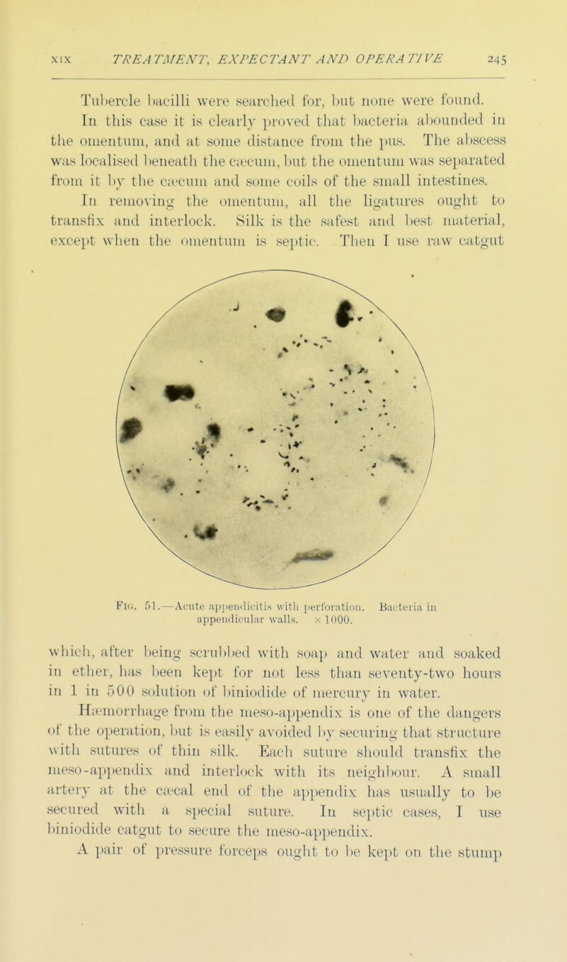 Tubercle bacilli were searched for, but none were found. In this ease it is clearly proved that bacteria abounded in the omentum, and at some distance from the pus. The abscess was Localised beneath the ceecum, but the omentum was separated from it by the carum and some coils of the small intestines. In removing the omentum, all the ligatures ought to transfix and interlock. Silk is the safest and best material, except when the omentum is septic. Then I use raw catgut Fk;. 51.—Acute appendicitis with perforation. Bacteria in appendicular walls. x 1000. which, after being scrubbed with soap and water and soaked in ether, has been kept for not less than seventy-two hours in 1 in 500 solution of biniodide of mercury in water. Haemorrhage from the meso-appendix is one of the dangers of the operation, but is easily avoided by securing that structure with sutures of thin silk. Each suture should transfix the meso-appendix and interlock with its neighbour. A small artery at the ca-cal end of the appendix has usually to be secured with a special suture. In septic cases, I use biniodide catgut to secure the meso-appendix. A pair of pressure forceps ought to he kept on the stump