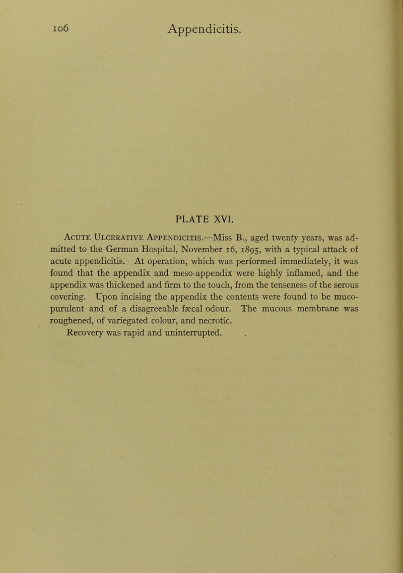 PLATE XVI. Acute Ulcerative Appendicitis.—Miss B., aged twenty years, was ad- mitted to the German Hospital, November i6, 1895, with a typical attack of acute appendicitis. At operation, which was performed immediately, it was found that the appendix and meso-appendix were highly inflamed, and the appendix was thickened and firm to the touch, from the tenseness of the serous covering. Upon incising the appendix the contents were found to be muco- pvirulent and of a disagreeable faecal odour. The mucous membrane was roughened, of variegated colour, and necrotic. Recovery was rapid and uninterrupted.