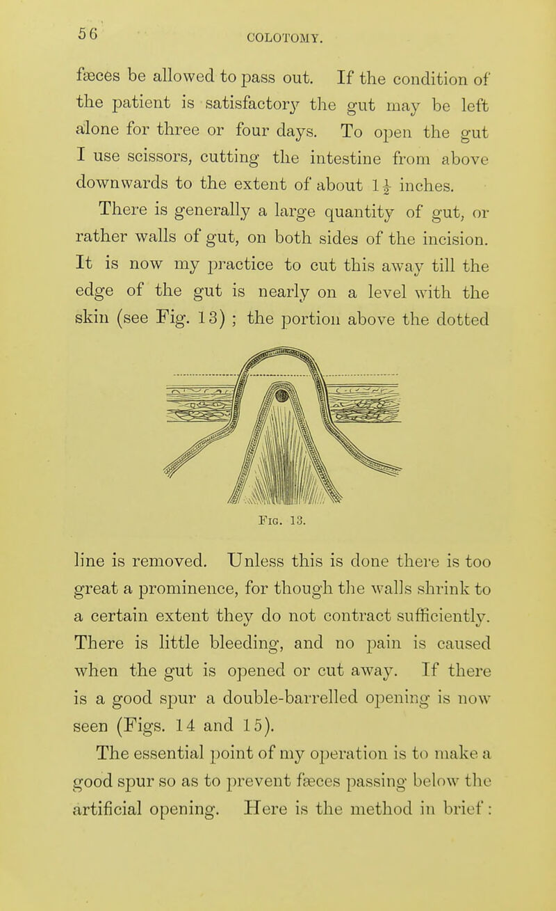 faeces be allowed to pass out. If the condition of the patient is satisfactor}^ the gut may be left alone for three or four days. To open the gut I use scissors, cutting the intestine from above downwards to the extent of about 1 ^ inches. There is generally a large quantity of gut, or rather walls of gut, on both sides of the incision. It is now my practice to cut this away till the edge of the gut is nearly on a level with the skin (see Fig. 13) ; the portion above the dotted Fig. 13. line is removed. Unless this is done there is too great a prominence, for though the walls shrink to a certain extent they do not contract sufficiently. There is little bleeding, and no pain is caused when the gut is opened or cut away. If there is a good spur a double-barrelled 02:)ening is now seen (Figs. 14 and 15). The essential point of my operation is to make a good spur so as to prevent faeces passing below the artificial opening. Here is the method in brief: