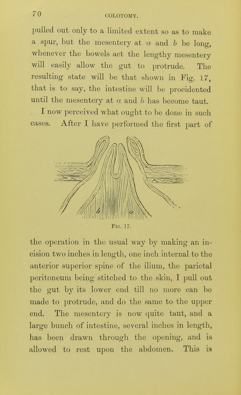 pulled out only to a limited extent so as to make a spur, but the mesentery at a and h be long, whenever the bowels act the lengthy mesentery will easily allow the gut to protrude. The resulting state will be that shown in Fig. 17, that is to say, the intestine will be proeidented until the mesentery at a and h has become taut. I now perceived what ought to be done in such cases. After I have performed the first part of Fig. 17. the operation in the usual way by making an in- cision two inches in length, one inch internal to the anterior superior spine of the ilium, the parietal peritoneum being stitched to the skin, I pull out the gut by its lower end till no more can be made to protrude, and do the same to the upper end. The mesentery is now quite taut, and a large bunch of intestine, several inches in length, has been drawn through the opening, and is allowed to rest upon the abdomen. This is