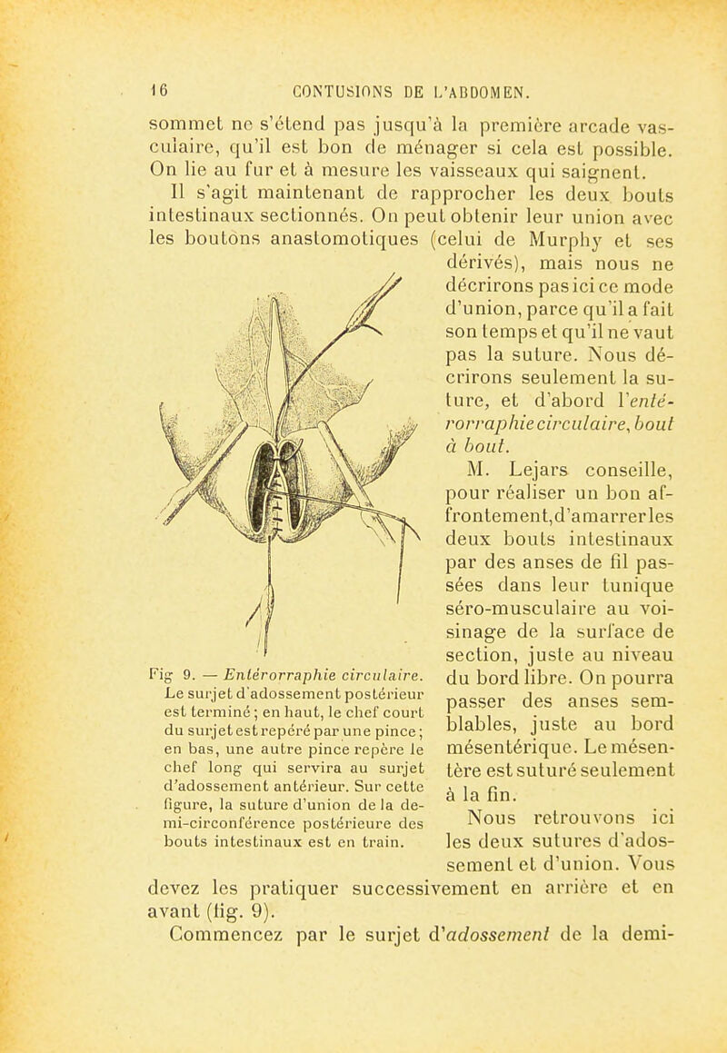 sommet ne s'étend pas jusqu'à la première arcade vas- cuiaire, qu'il est bon de ménager si cela est possible. On lie au fur et à mesure les vaisseaux qui saignent. Il s'agit maintenant de rapprocher les deux bouts intestinaux sectionnés. On peut obtenir leur union avec les boutons anastomotiques (celui de Murphy et ses dérivés), mais nous ne décrirons pas ici ce mode d'union, parce qu'il a fait son temps et qu'il ne vaut pas la suture. Nous dé- crirons seulement la su- ture, et d'abord Venté- rorrapliie circulaire, bout à bout. M. Lejars conseille, pour réaliser un bon af- frontement,d'amarrerles deux bouts intestinaux par des anses de fil pas- sées dans leur tunique séro-musculaire au voi- sinage de la surface de section, juste au niveau du bord libre. On pourra passer des anses sem- blables, juste au bord mésentérique. Le mésen- tère est suturé seulement à la fin. Nous retrouvons ici les deux sutures d'ados- Fig 9. —Enlérorraphie circulaire. Le surjet d'adossement postérieur est terminé ; en haut, le chef court du surjet est repéré par une pince; en bas, une autre pince repère le chef long qui servira au surjet d'adossement antérieur. Sur cette figure, la suture d'union de la de- mi-circonférence postérieure des bouts intestinaux est en train. sèment et d'union. Vous devez les pratiquer successivement en arrière et en avant (iig. 9). Commencez par le surjet d'adossement de la demi-