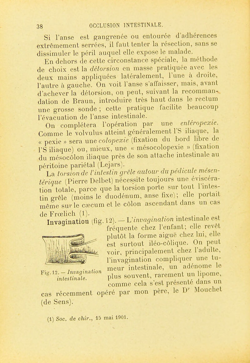 Si l'anse est gangrenée ou enlource d'adhérences extrêmement serrées, il faut tenter la résection, sans se dissimuler le péril auquel elle expose le malade. En dehors de cette circonstance spéciale, la méthode de choix est la clélorsion en masse pratiquée avec les deux mains appliquées latéralement, l'une à droite, l'autre à gauche. On voit l'anse s'affaisser, mais, avant d'achever la détorsion, on peut, suivant la recomman- dation de Braun, introduire très haut dans le rectum une grosse sonde ; cette pratique facilite beaucoup l'évacuation de l'anse intestinale. On complétera l'opération par une enlérnpexie. Comme le volvulus atteint généralement l'S iliaque, la « pexie » sera nv^a colopexie (fixation du bord libre de l'SiUaque) ou, mieux, une « mésocolopexie » (fixation du mésocôlon ihaque près de son attache intestinale au péritoine pariétal (Lejars). La torsion de F intestin grêle autour du pédicule mesen- lérique (Pierre Delbet) nécessite toujours une éviscéra- tion totale, parce que la torsion porte sur tout l'intes- tin grêle (moins le duodénum, anse fixe); elle portait même sur le cœcura et le côlon ascendant dans un cas de Frœhch (1). . ,• • t ,• i f Invagination ifig. 12). -1:invagination intestinale es fréquente chez l'enfant; elle revêt plutôt la forme aiguë chez lui, elle est surtout iléo-côhque. On peut voir, principalement chez l'adulte, l'invagination compliquer une tu- . meur intestinale, un adénome le ° Pl- .ouvenl, rarement un lipome comme cela s est présenté dans un cas récemment opéré par mon père, le D Mouchet (de Sens). (1) Soc. de chir., 15 mai 1901.