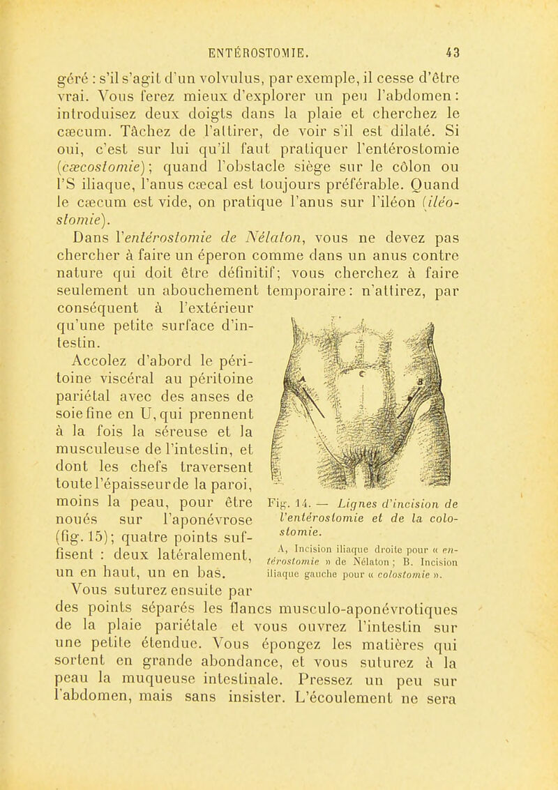 géré : s'il s'agit d'un volvulus, par exemple, il cesse d'être vrai. Vous ferez mieux d'explorer un peu l'abdomen : introduisez deux doigts dans la plaie et cherchez le ceecum. Tâchez de l'attirer, de voir s'il est dilaté. Si oui, c'est sur lui qu'il faut pratiquer l'entérostomie [ccecostomie) ; quand l'obstacle siège sur le côlon ou rS iliaque, l'anus cœcal est toujours préférable. Quand le caecum est vide, on pratique l'anus sur l'iléon iiléo- slomie). Dans Ventérostomie de Nélalon, vous ne devez pas chercher à faire un éperon comme dans un anus contre nature qui doit être définitif; vous cherchez à faire seulement un abouchement temporaire : n'attirez, par conséquent à l'extérieur qu'une petite surface d'in- testin. Accolez d'abord le péri- toine viscéral au péritoine pariétal avec des anses de soie fine en U,qui prennent à la fois la séreuse et la musculeuse de l'intestin, et dont les chefs traversent toute l'épaisseur de la paroi, moins la peau, pour être noués sur l'aponévrose (fig. 15); quatre points suf- fisent : deux latéralement, un en haut, un en bas. Vous suturez ensuite par des points séparés les flancs musculo-aponévrotiques de la plaie pariétale et vous ouvrez l'intestin sur une petite étendue. Vous épongez les matières qui sortent en grande abondance, et vous suturez à la peau la muqueuse intestinale. Pressez un peu sur l'abdomen, mais sans insister. L'écoulement ne sera Fij^-. 14. — Lignes d'incision de l'enlérosiomie et de la colo- slomie. A, Incision iliaque droite pour « pii- tci-ostomie » de Nélaton ; B. Incision iliaque gauche pour « colostomie ».