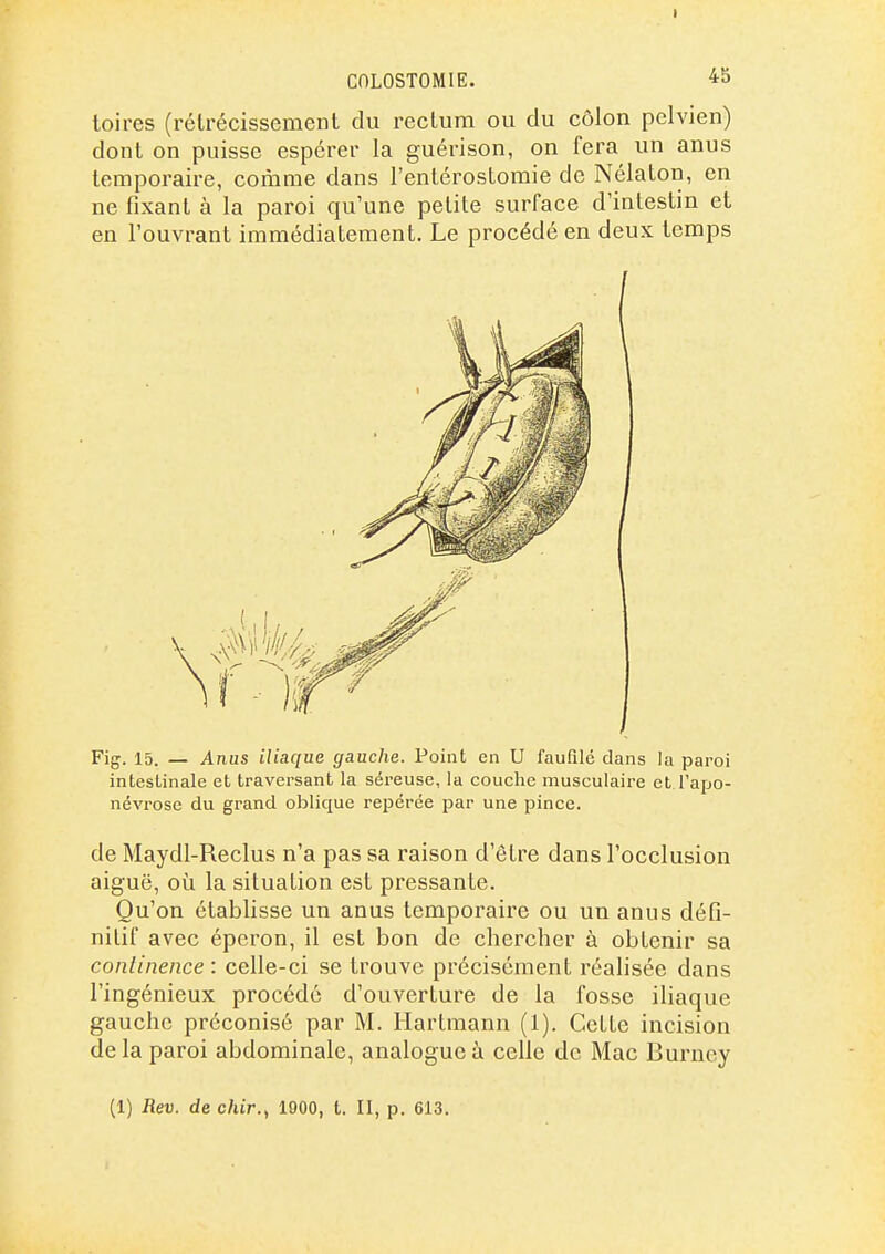 COLOSTOMIE. *5 loires (rétrécissement du i^ectum ou du côlon pelvien) dont on puisse espérer la guérison, on fera un anus temporaire, comme dans l'entérostomie de Nélaton, en ne fixant à la paroi qu'une petite surface d'intestin et en l'ouvrant immédiatement. Le procédé en deux temps Fig. 15. — Anus iliaque gauche. Point en U faufilé dans la paroi intestinale et traversant la séreuse, la couche musculaire et l'apo- névroso du grand oblique repérée par une pince. de Maydl-Reclus n'a pas sa raison d'être dans l'occlusion aiguë, où la situation est pressante. Qu'on établisse un anus temporaire ou un anus défi- nitif avec éperon, il est bon de chercher à obtenir sa conlinence : celle-ci se trouve précisément réalisée dans l'ingénieux procédé d'ouverture de la fosse iliaque gauche préconisé par M. Hartmann (1). Cette incision de la paroi abdominale, analogue à celle de Mac Burney (1) Rev. de c/uV., 1900, t. II, p. 613.