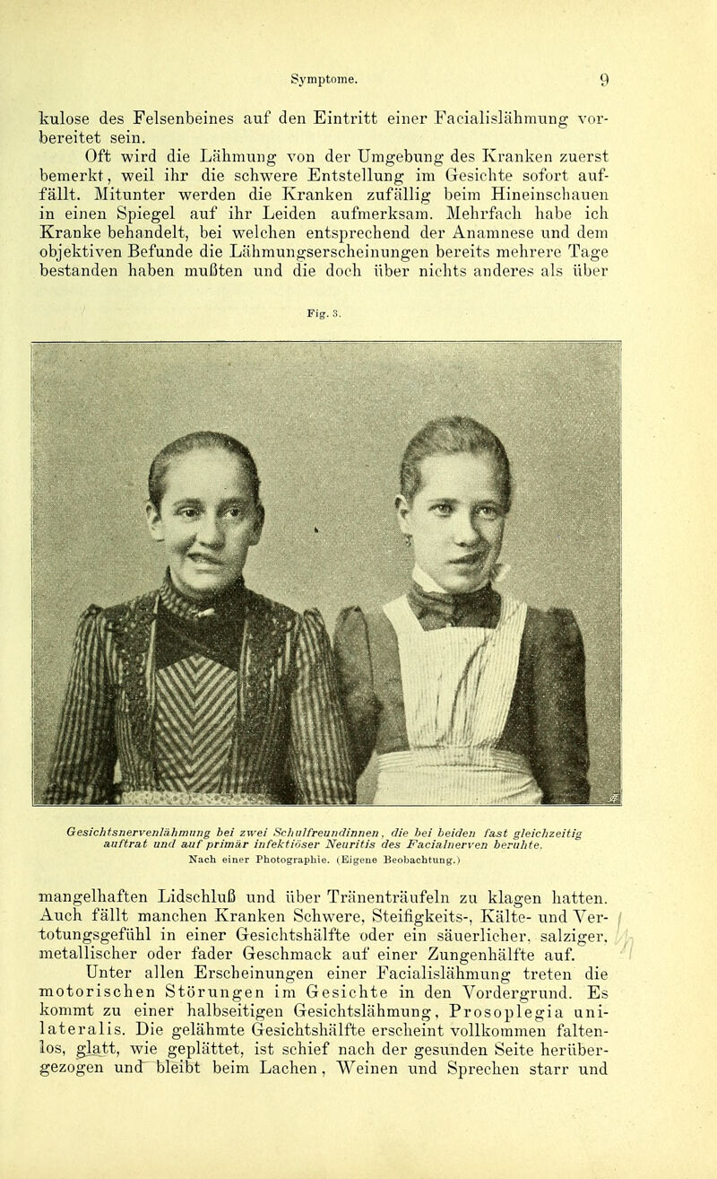 kulose des Felsenbeines auf den Eintritt einer Facialislähmung vor- bereitet sein. Oft wird die Lähmung von der Umgebung des Ki'anken zuerst bemerkt, weil ihr die schwere Entstellung im Gesichte sofort auf- fällt. Mitunter werden die Kranken zufällig beim Hineinschauen in einen Spiegel auf ihr Leiden aufmerksam. Mehrfach habe ich Kranke behandelt, bei welchen entsprechend der Anamnese und dem objektiven Befunde die Lähmungserscheinungen bereits mehrere Tage bestanden haben mußten und die doch über nichts anderes als über Fig. 3. Gesichtsnervenlähmung bei zwei Schulfreundinnen. die bei beiden fast gleichzeitig auftrat und auf primär infektiöser Neuritis des Facialnerven beruhte. Nach einer Photographie. (Eigene Beobachtung.) mangelhaften Lidschluß und über Tränenträufeln zu klagen hatten. Auch fällt manchen Kranken Schwere, Steifigkeits-, Kälte- und A^er- totungsgefühl in einer Gesichtshälfte oder ein säuerlicher, salziger, metallischer oder fader Geschmack auf einer Zungenhälfte auf. Unter allen Erscheinungen einer Facialislähmung treten die motorischen Störungen im Gesichte in den Vordergrund. Es kommt zu einer halbseitigen Gesichtslähmung, Prosoplegia uni- lateralis. Die gelähmte Gesichtshälfte erseheint vollkommen falten- los, gktt, wie geplättet, ist schief nach der gesunden Seite herüber- gezogen und bleibt beim Lachen, Weinen und Sprechen starr und