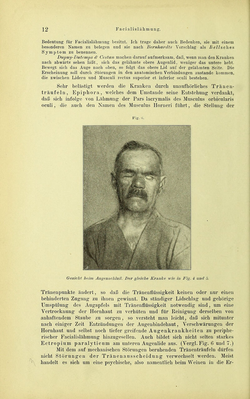Bedeutung für Facialislälimung besitzt. Ich trage daher auch Bedenken, sie mit einem besonderen Namen zu belegen und sie nach Bernhardts Vorschlag als ße^sches Symptom zu benennen. Dupuij-Dutemps & Cestan machen darauf aufmerksam, daß, wenn man den Kranken nach abwärts sehen läßt, sich das gelähmte obere Augenlid, weniger das untere hebt. Bewegt sich das Auge nach oben, so folgt das obere Lid auf der gelähmten Seite. Die Erscheinung soll durch Störungen in den anatomischen Verbindungen zustande kommen, die zwischen Lidern und Musculi rectus superior et inferior oculi bestehen. Sehr belästigt werden die Kranken durch unaufhörliches Tränen- träufeln, Epiphora, welches dem Umstände seine Entstehung verdankt, daß sich infolge von Lähmung der Pars lacrymalis des Musculus orbicularis oculi, die auch den Namen des Musculus Horneri führt, die Stellung der Fig. 0. Gesicht beim Augensclilaß. Der gleiche Kranke wie in Fig. i und 5. Tränenpunkte ändert, so daß die Tränenflüssigkeit keinen oder nur einen behinderten Zugang zu ihnen gewinnt. Da ständiger Lidschlag und gehörige Umspülung des Augapfels mit Tränenflüssigkeit notwendig sind, um eine Vertrocknung der Hornhaut zu verhüten und für Reinigung derselben von anhaftendem Staube zu sorgen, so versteht man leicht, daß sich mitunter nach einiger Zeit Entzündungen der Augenbindehaut, Verschwärungen der Hornhaut und selbst noch tiefer greifende Augenkrankheiten zu pei'iphe- rischer Facialislähmung hinzugesellen. Auch bildet sich nicht selten starkes Ectropium paralyticum am unteren Augenlide aus. (Vergl. Fig. 6 und 7.) Mit dem auf mechanischen Störungen beruhenden Tränenträufeln dürfen nicht Störungen der Tränenausscheidung verwechselt werden. Meist handelt es sich um eine psychische, also namentlich beim Weinen in die Er-