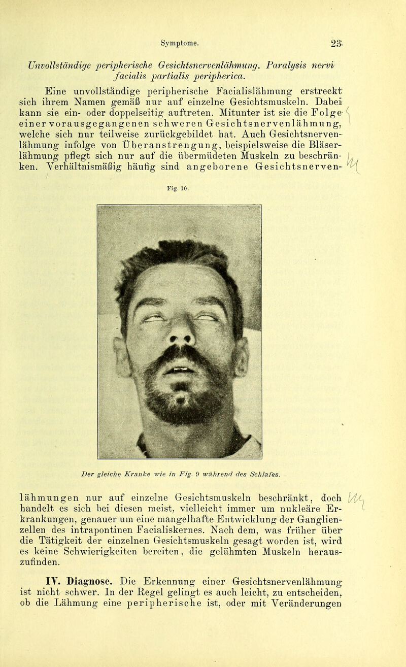 Unvollständige peripherische Gesichtsnervenlähmung. Paralysis nervi facialis partialis peripherica. Eine unvollständige peripherische Facialislähmnng erstreckt sich ihrem Namen gemäß nur auf einzelne Gesichtsmuskeln. Dabei kann sie ein- oder doppelseitig auftreten. Mitunter ist sie die Folge einer vorausgegangenen schweren Gresichtsnervenlähmung, welche sich nur teilweise zurückgebildet hat. Auch Gesichtsnerven- lähmung infolge von Überanstrengung, beispielsweise die Bläser- lähmung pflegt sich nur auf die übermüdeten Muskeln zu beschrän- ken. Verhältnismäßig häufig sind angeborene Gesichtsnerven- lähmungen nur auf einzelne Gesichtsmuskeln beschränkt, doch handelt es sich bei diesen raeist, vielleicht immer um nukleare Er- krankungen, genauer um eine mangelhafte Entwicklung der Ganglien- zellen des intrapontinen Facialiskernes. Nach dem, was früher über die Tätigkeit der einzelnen Gesichtsmuskeln gesagt worden ist, wird es keine Schwierigkeiten bereiten, die gelähmten Muskeln heraus- zufinden. IV. Diagnose. Die Erkennung einer Gesichtsnervenlähmung ist nicht schwer. In der Regel gelingt es auch leicht, zu entscheiden, ob die Lähmung eine peripherische ist, oder mit Veränderungen Fig. 10. Der gleiche Krajike wie in Fig. 0 wiilirenrl des Schlafes.