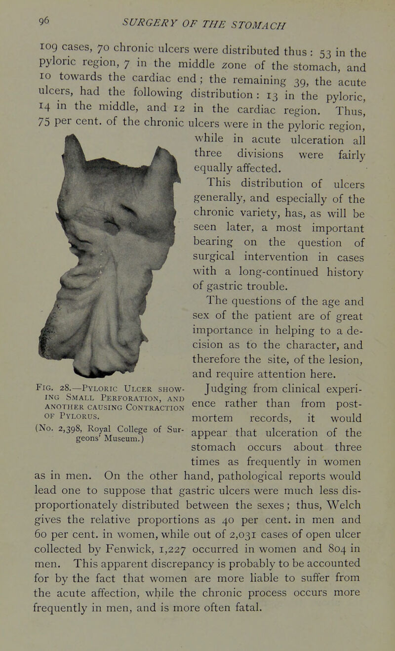 were fairly 109 cases, 70 chronic ulcers were distributed thus : 53 in the pyloric region, 7 in the middle zone of the stomach, and 10 towards the cardiac end; the remaining 39, the acute ulcers, had the following distribution : 13 in the pyloric, 14 in the middle, and 12 in the cardiac region. Thus! 75 per cent, of the chronic ulcers were in the pyloric region' while in acute ulceration all three divisions equally affected. This distribution of ulcers generally, and especially of the chronic variety, has, as will be seen later, a most important bearing on the question of surgical intervention in cases with a long-continued history of gastric trouble. The questions of the age and sex of the patient are of great importance in helping to a de- cision as to the character, and therefore the site, of the lesion, and require attention here. Judging from clinical experi- ence rather than from post- mortem records, it would appear that ulceration of the stomach occurs about three times as frequently in women as in men. On the other hand, pathological reports would lead one to suppose that gastric ulcers were much less dis- proportionately distributed between the sexes; thus, Welch gives the relative proportions as 40 per cent, in men and 60 per cent, in women, while out of 2,031 cases of open ulcer collected by Fenwick, 1,227 occurred in women and 804 in men. This apparent discrepancy is probably to be accounted for by the fact that women are more liable to suffer from the acute affection, while the chronic process occurs more frequently in men, and is more often fatal. Fig. 28.—Pyloric Ulcer show- ing Small Perforation, and another causing contraction OF Pylorus. (No. 2,398, Royal College of Sur- geons' Museum.)